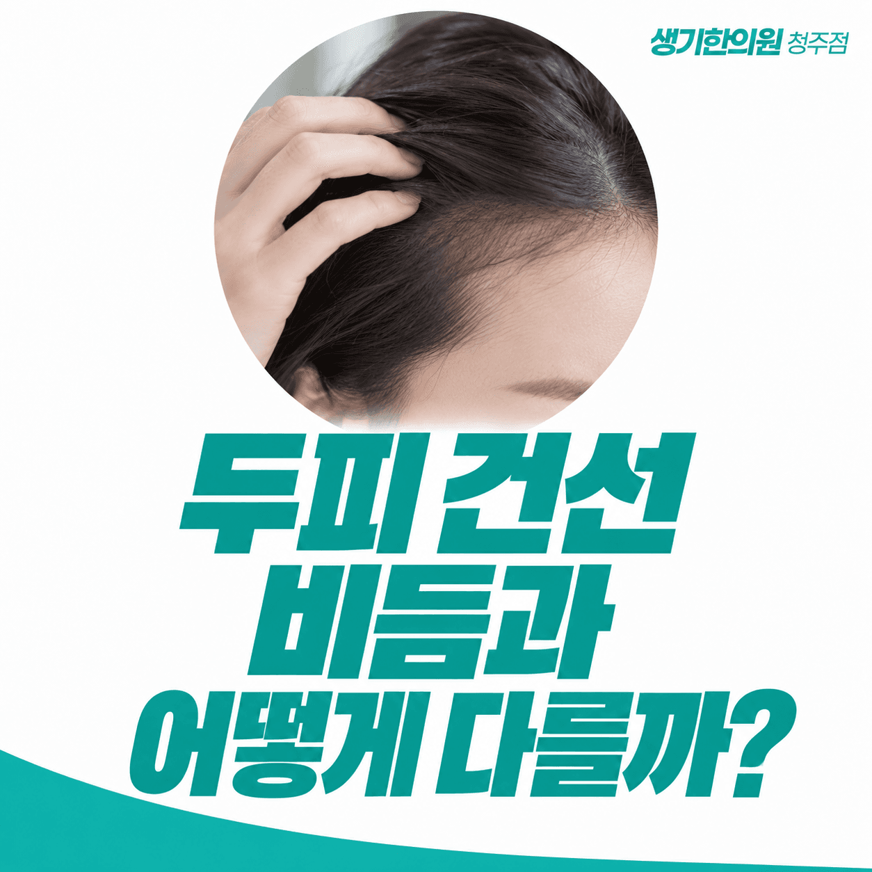 두피 건선 비듬과 어떻게 다를까 — 머리카락과 두피를 살펴보는 모습의 주제 썸네일