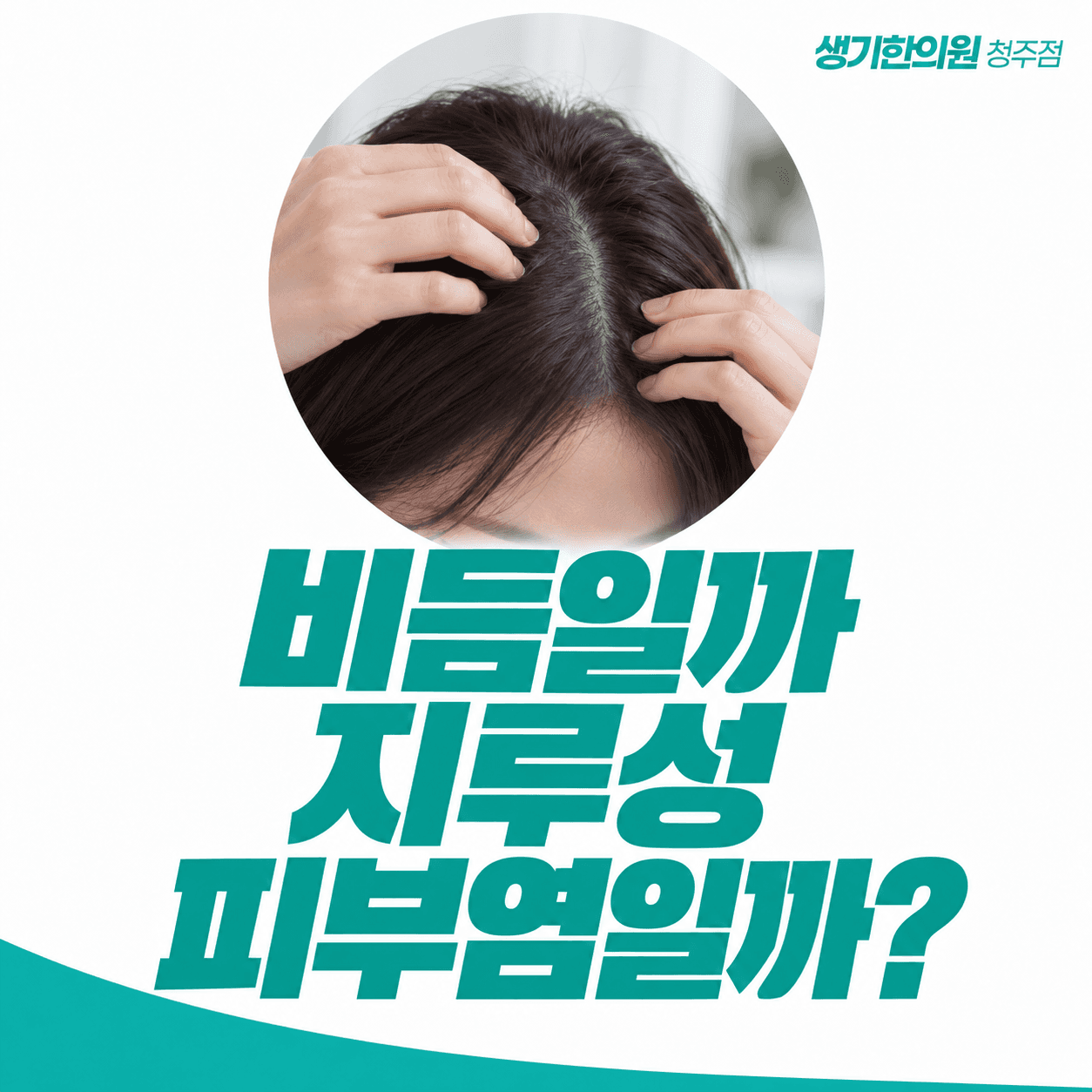 비듬일까 지루성피부염일까 — 두피를 살펴보는 모습의 주제 썸네일
