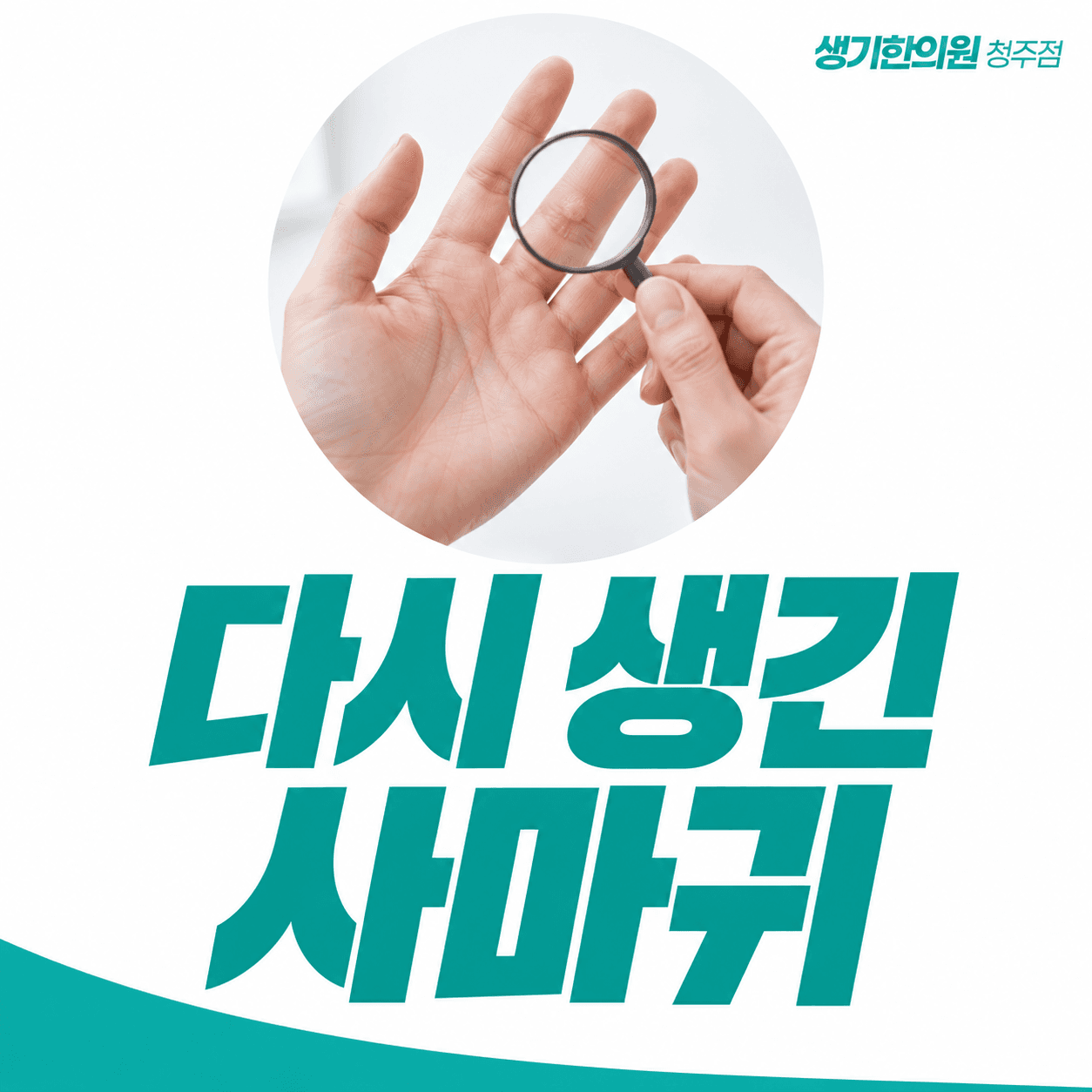 다시 생긴 사마귀 — 돋보기로 손을 살펴보는 모습의 주제 썸네일