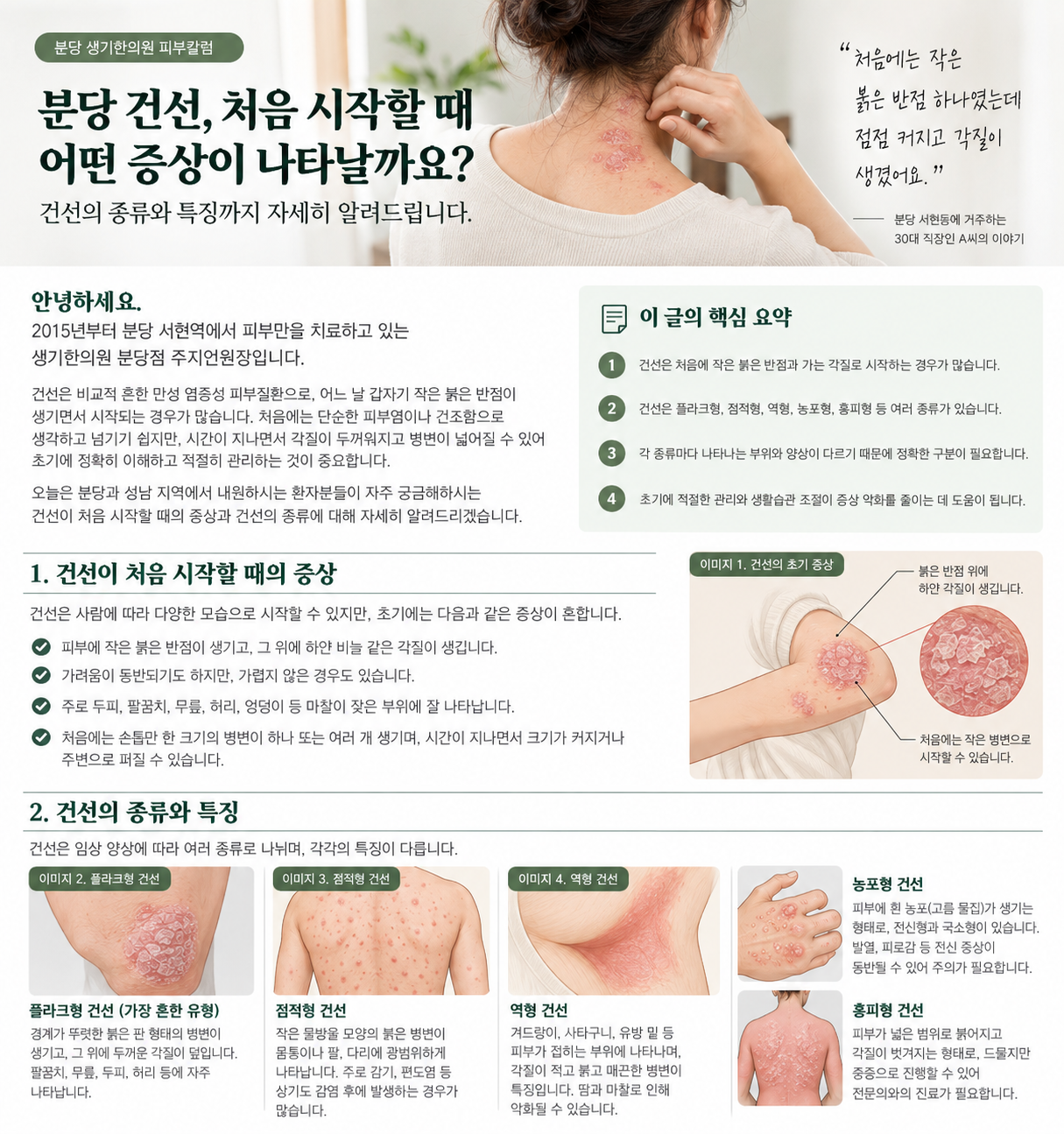 분당 생기한의원에서 제작한 건선 초기의 붉은 반점과 은백색 각질을 표현한 설명용 삽화