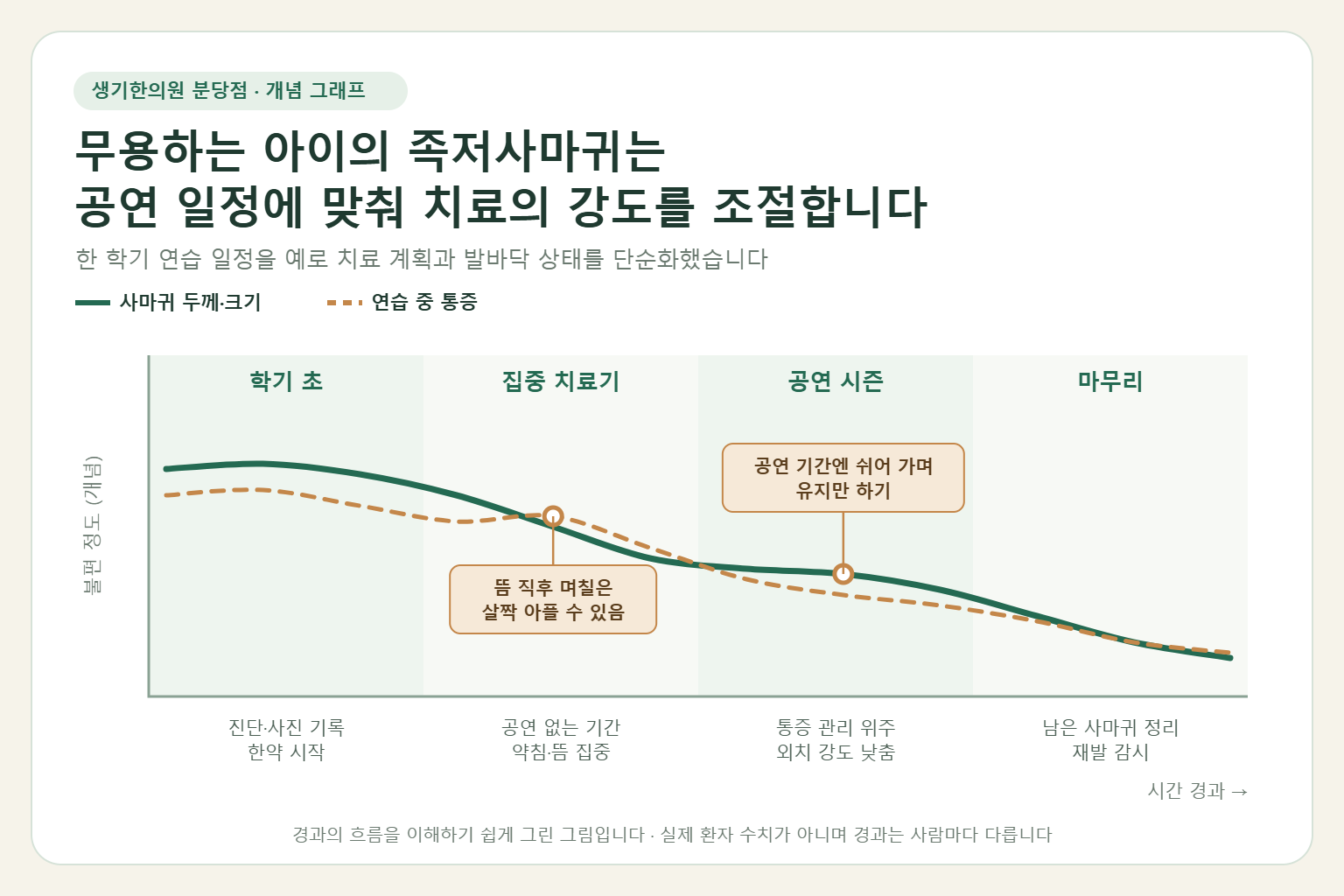 한 학기 무용 연습 일정 동안 학기 초, 집중 치료기, 공연 시즌, 마무리 단계에 따라 족저사마귀의 두께와 연습 중 통증이 줄어드는 치료 계획을 보여 주는 개념 그래프