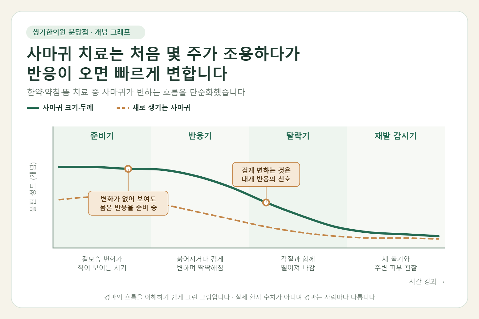 손톱 주변 사마귀의 한의 치료 중 준비기, 반응기, 탈락기, 재발 감시기에 따라 사마귀 크기와 새로 생기는 사마귀 수가 줄어드는 흐름을 보여 주는 개념 그래프