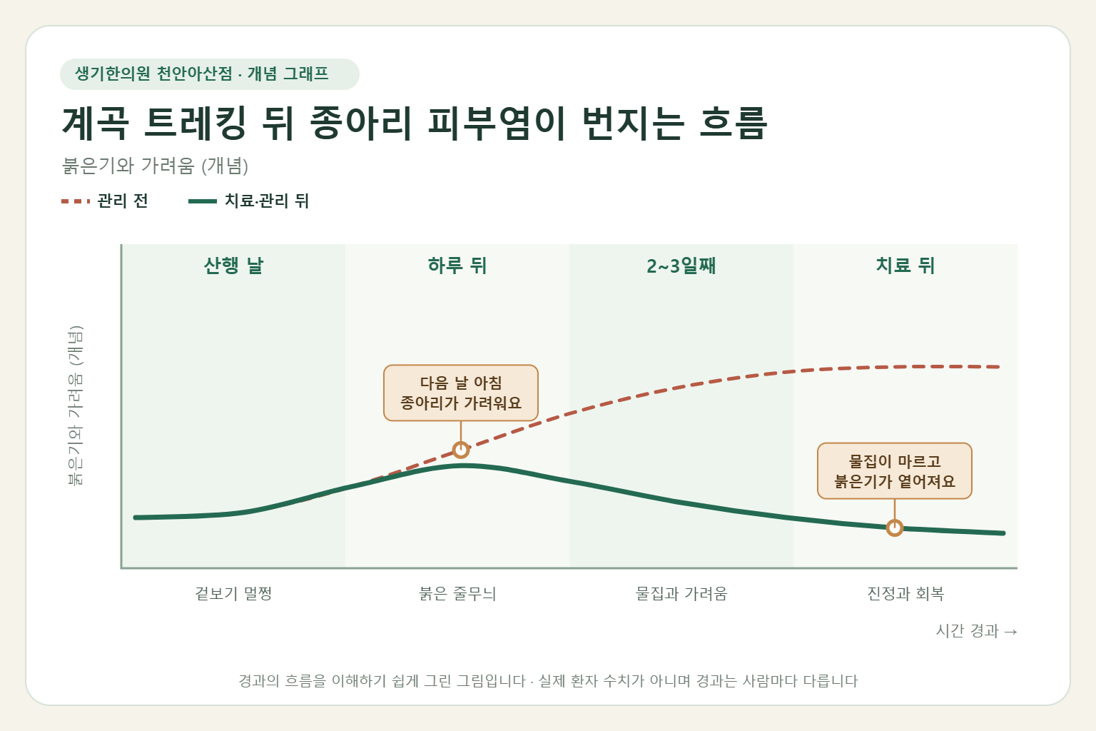 계곡 트레킹 뒤 종아리 피부염이 번지는 흐름과 치료 뒤 변화를 그린 개념 그래프