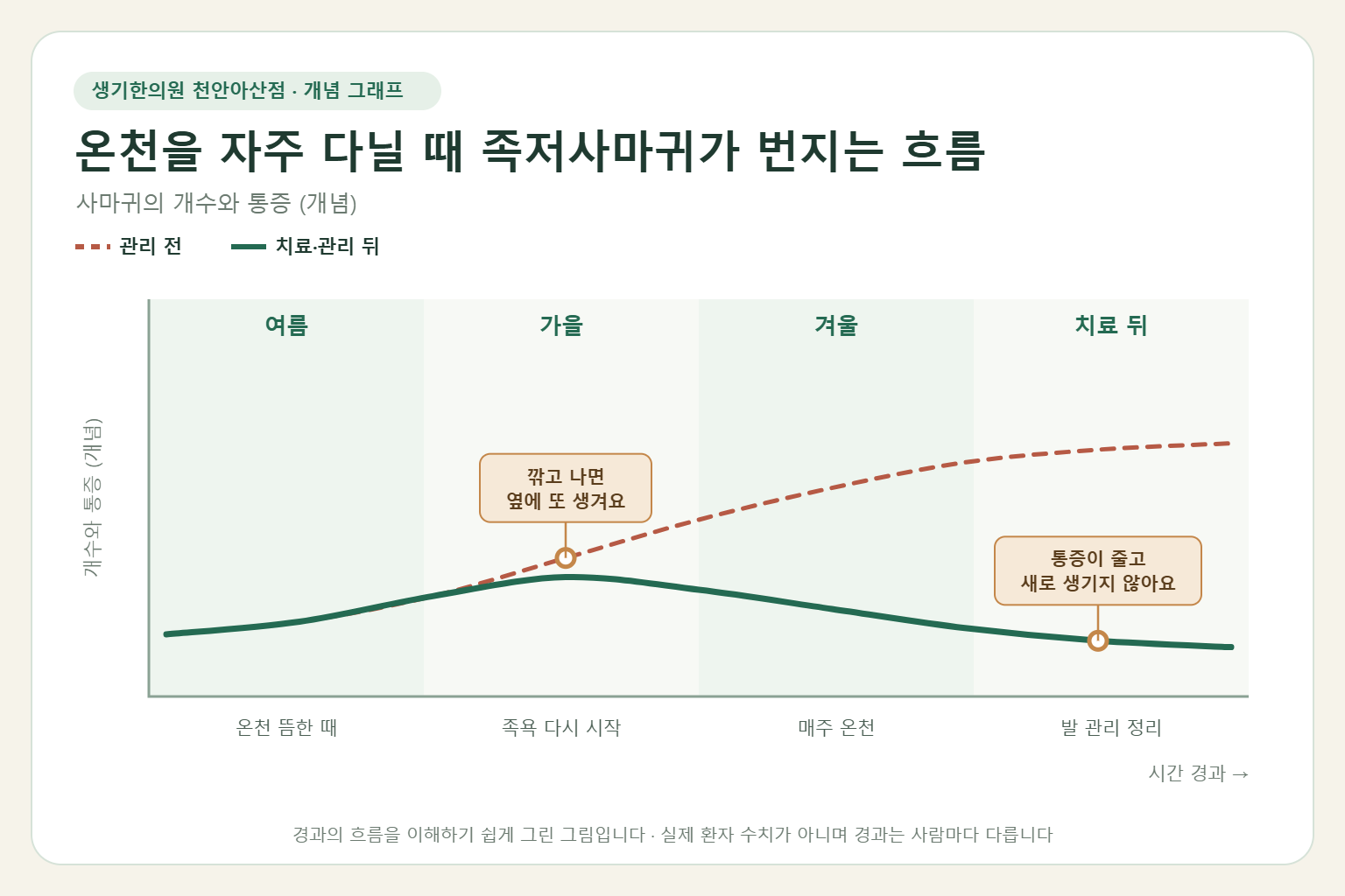 온천을 자주 다닐 때 족저사마귀가 번지는 흐름과 치료 뒤 변화를 그린 개념 그래프