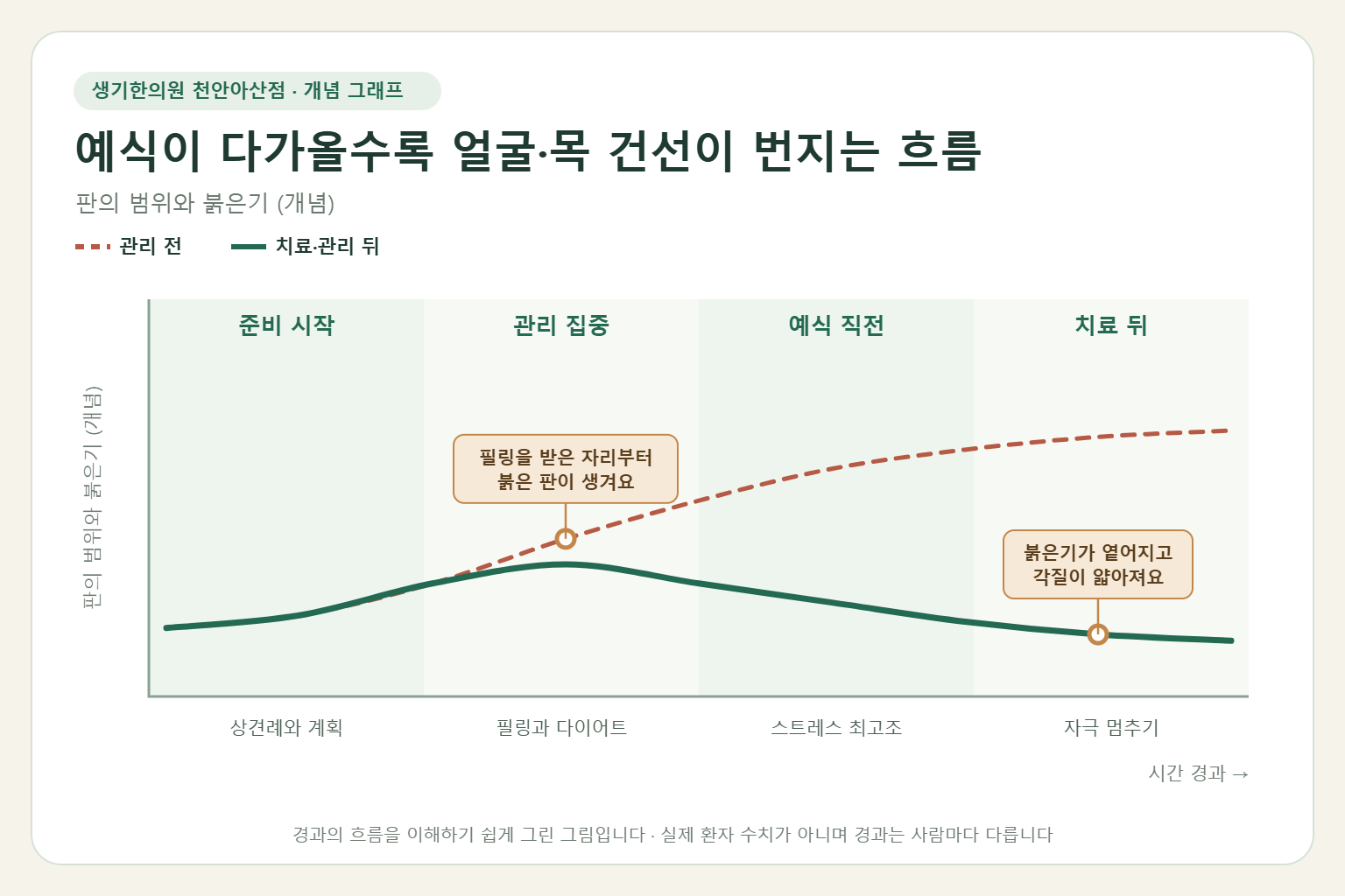 예식이 다가올수록 얼굴·목 건선이 번지는 흐름과 치료 뒤 변화를 그린 개념 그래프