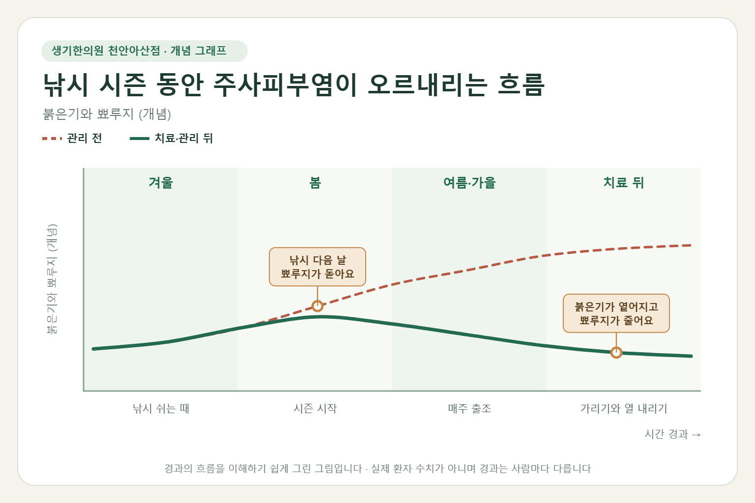 낚시 시즌 동안 주사피부염이 오르내리는 흐름과 치료 뒤 변화를 그린 개념 그래프