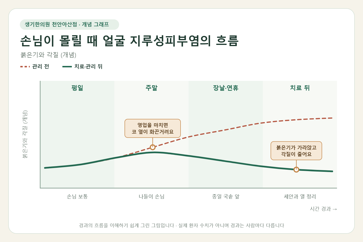 손님이 몰릴 때 얼굴 지루성피부염의 흐름과 치료 뒤 변화를 그린 개념 그래프