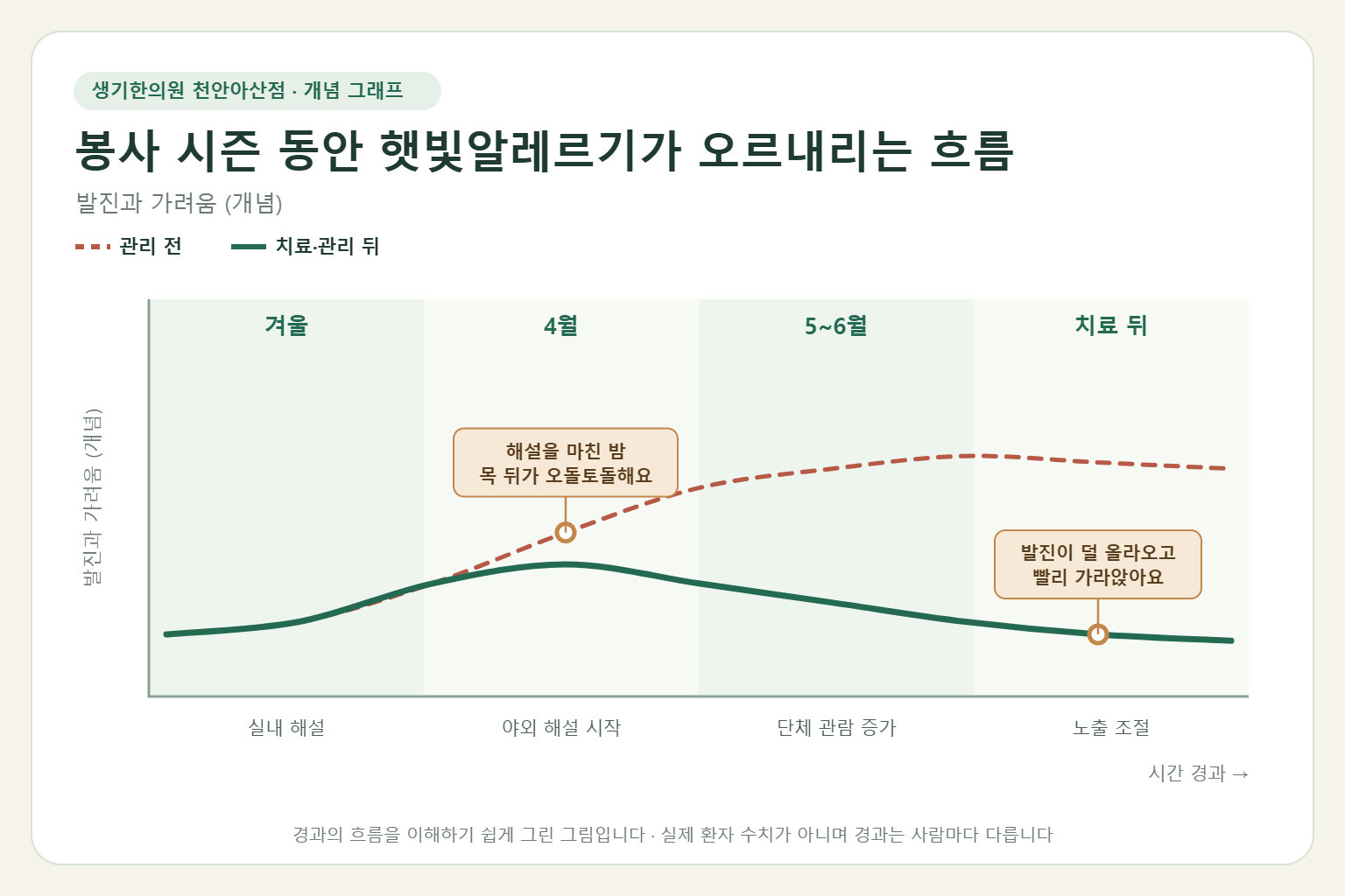 봉사 시즌 동안 햇빛알레르기가 오르내리는 흐름과 치료 뒤 변화를 그린 개념 그래프