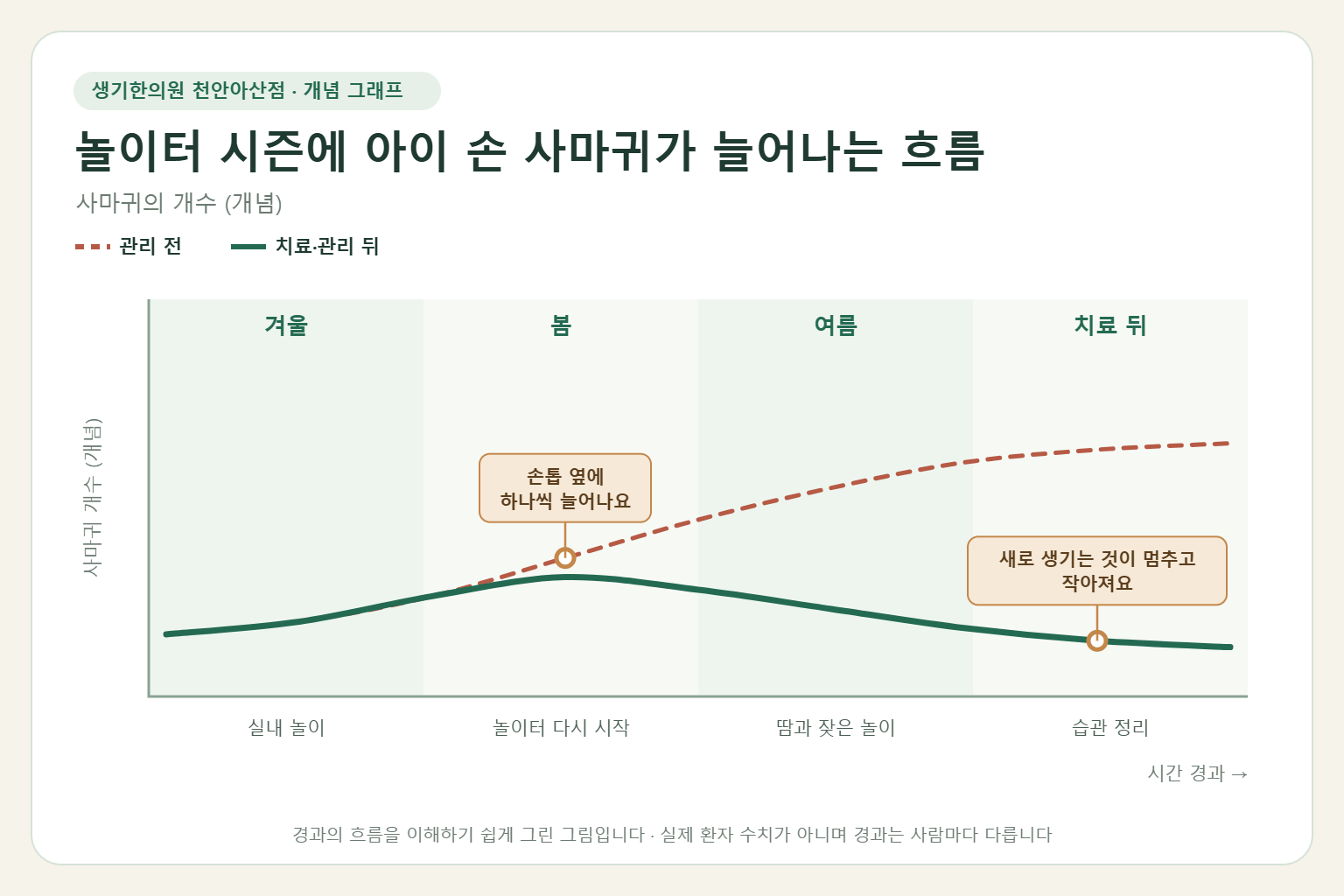 놀이터 시즌에 아이 손 사마귀가 늘어나는 흐름과 치료 뒤 변화를 그린 개념 그래프