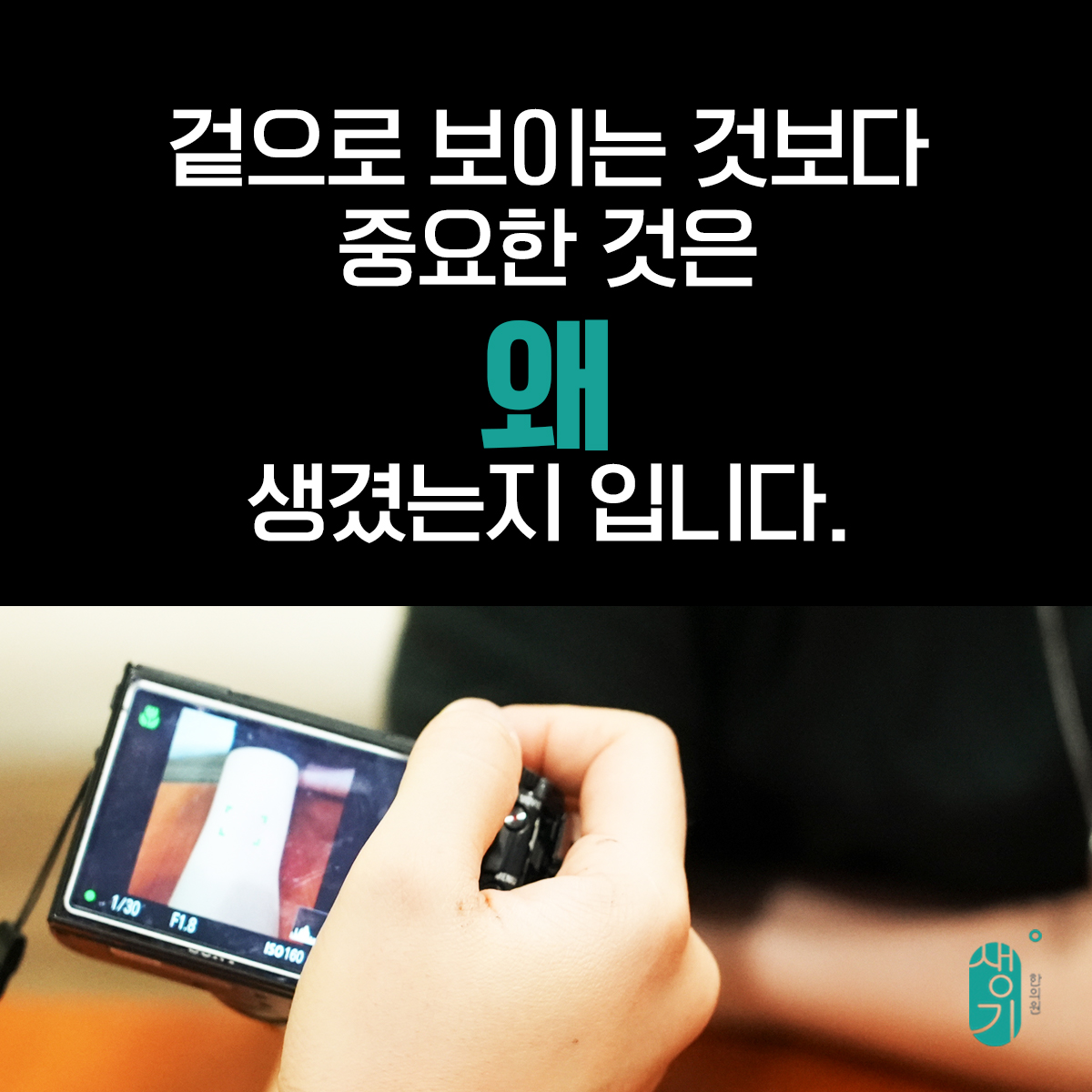 카메라로 팔을 촬영하는 사진과 문구 「겉으로 보이는 것보다 중요한 것은 왜 생겼는지 입니다.」