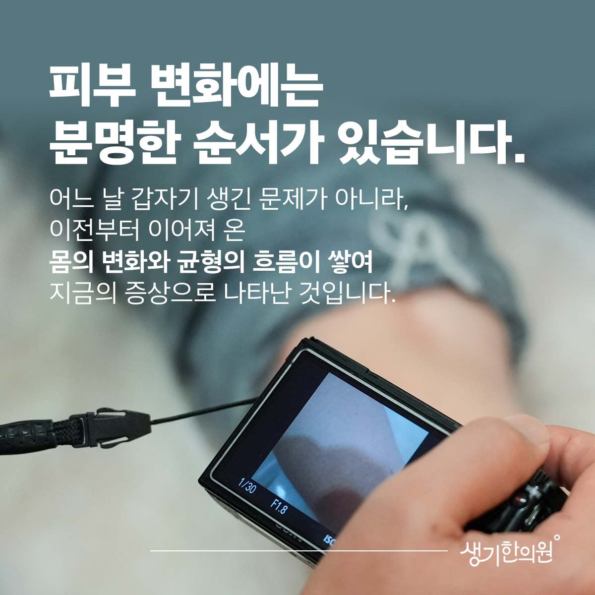 카메라 화면 속 피부 사진과 문구 「피부 변화에는 분명한 순서가 있습니다.」