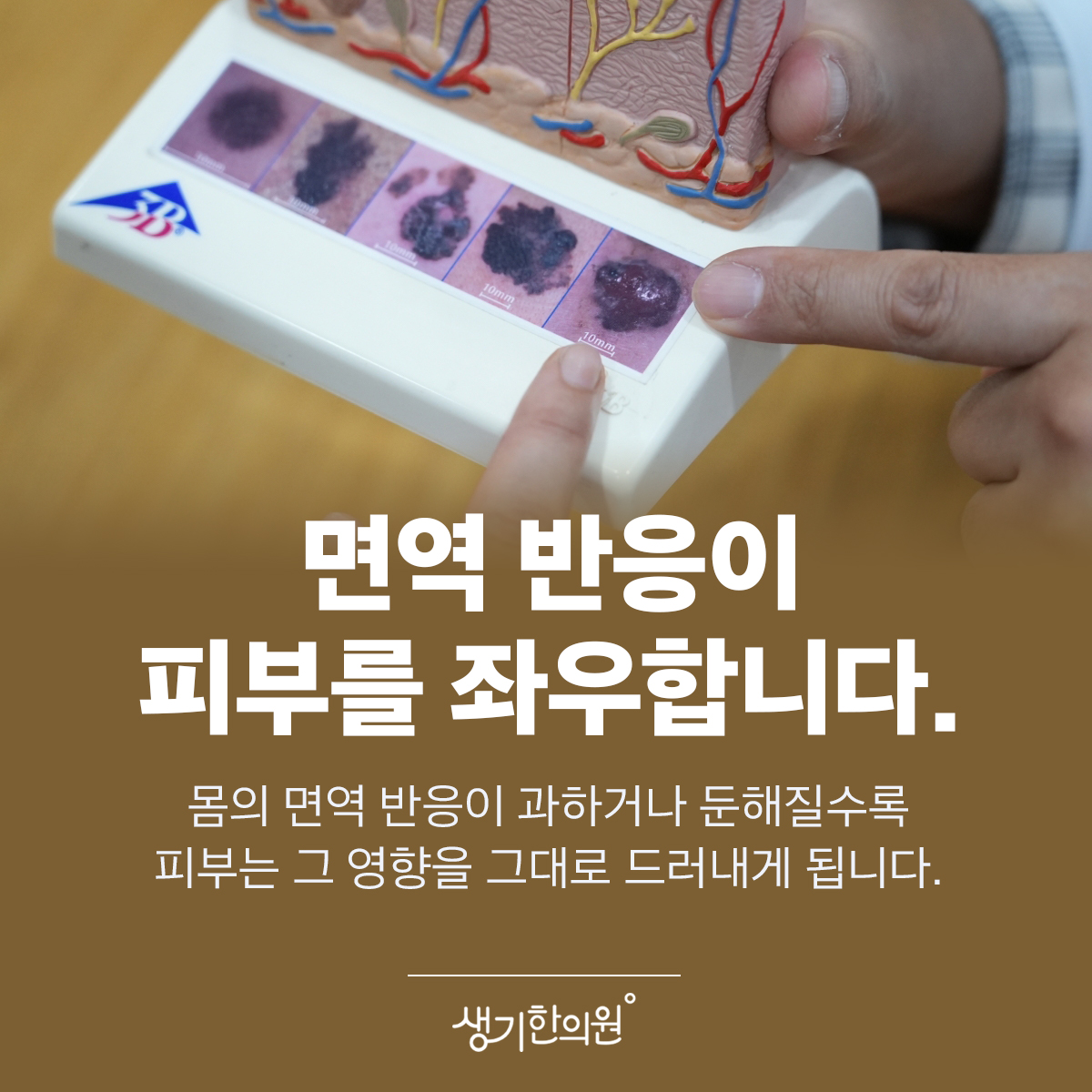 피부 구조 모형을 가리키는 사진과 문구 「면역 반응이 피부를 좌우합니다.」