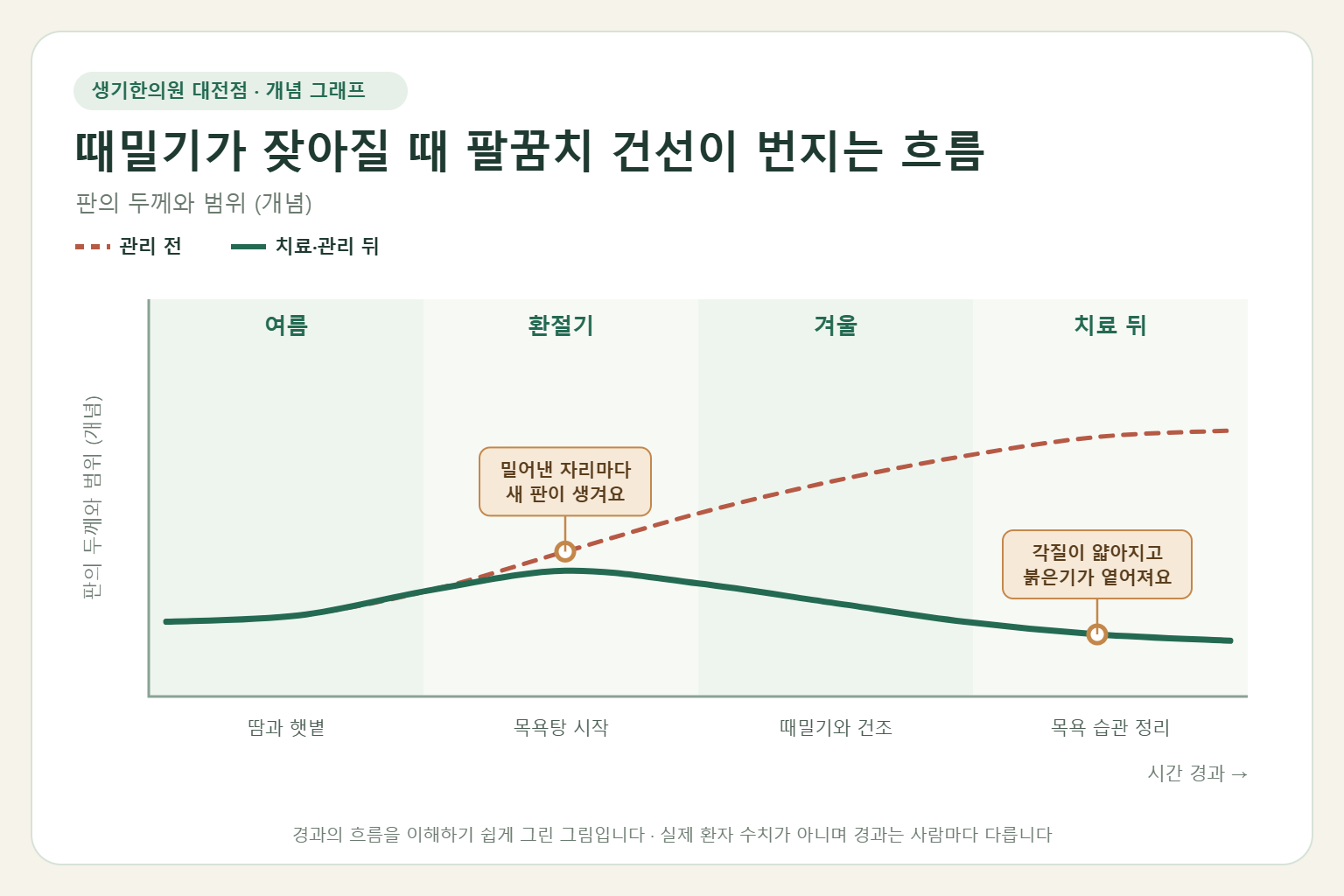 때밀기가 잦아질 때 팔꿈치 건선이 번지는 흐름과 치료 뒤 변화를 그린 개념 그래프
