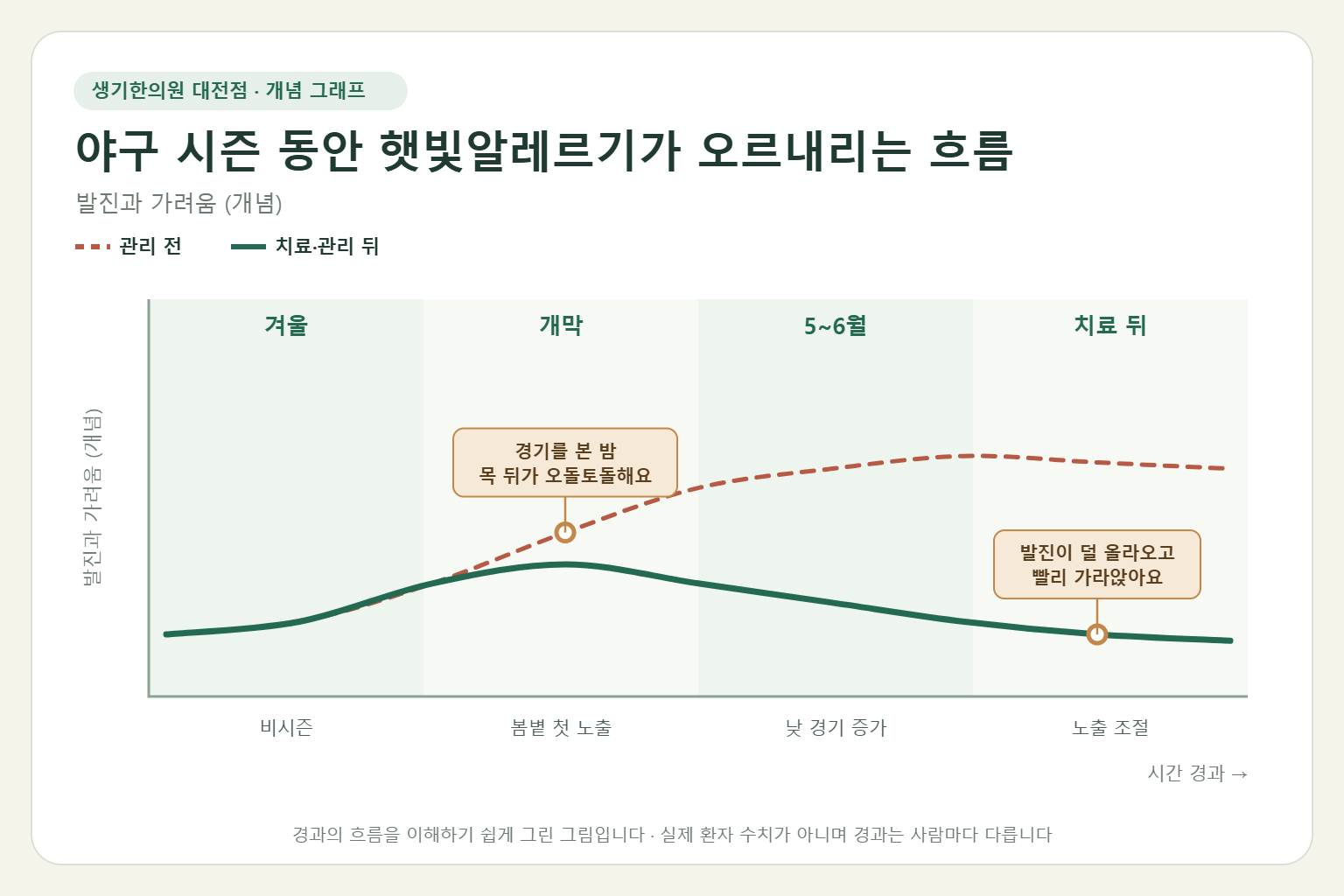 야구 시즌 동안 햇빛알레르기가 오르내리는 흐름과 치료 뒤 변화를 그린 개념 그래프