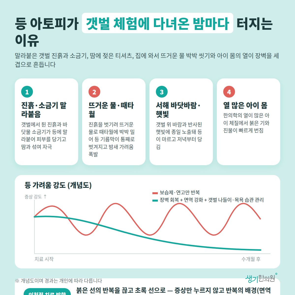 등 아토피가 갯벌 체험에 다녀온 밤마다 터지는 이유 — 진흙·소금기 말라붙음, 뜨거운 물·때타월, 서해 바닷바람·햇빛, 열 많은 아이 몸 4가지와 치료 경과 개념 그래프