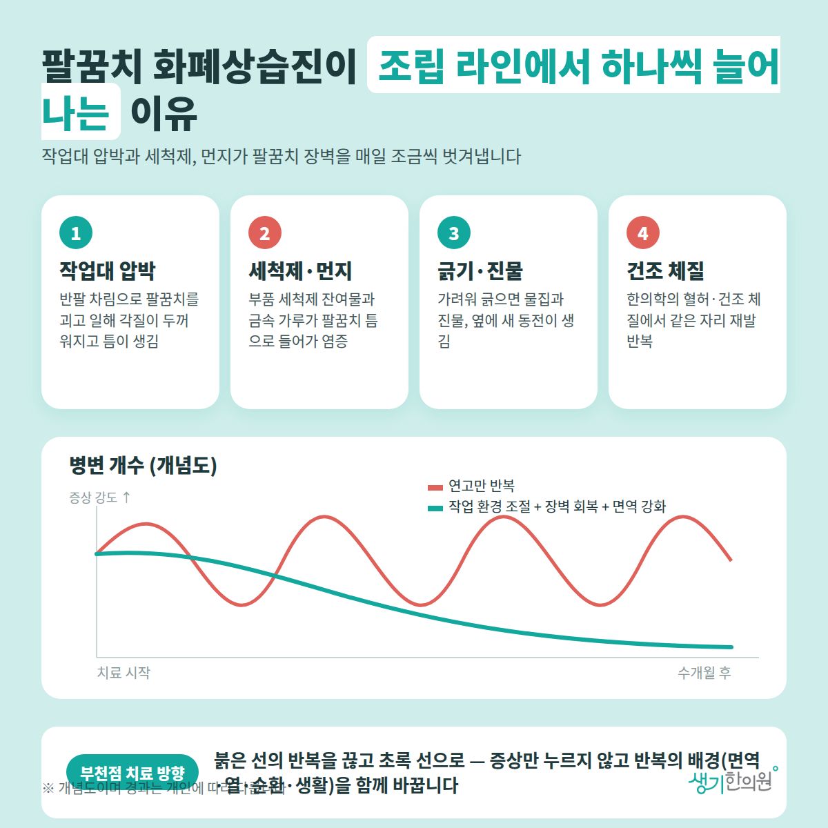 팔꿈치 화폐상습진이 조립 라인에서 하나씩 늘어나는 이유 — 작업대 압박, 세척제·먼지, 긁기·진물, 건조 체질 4가지와 치료 경과 개념 그래프