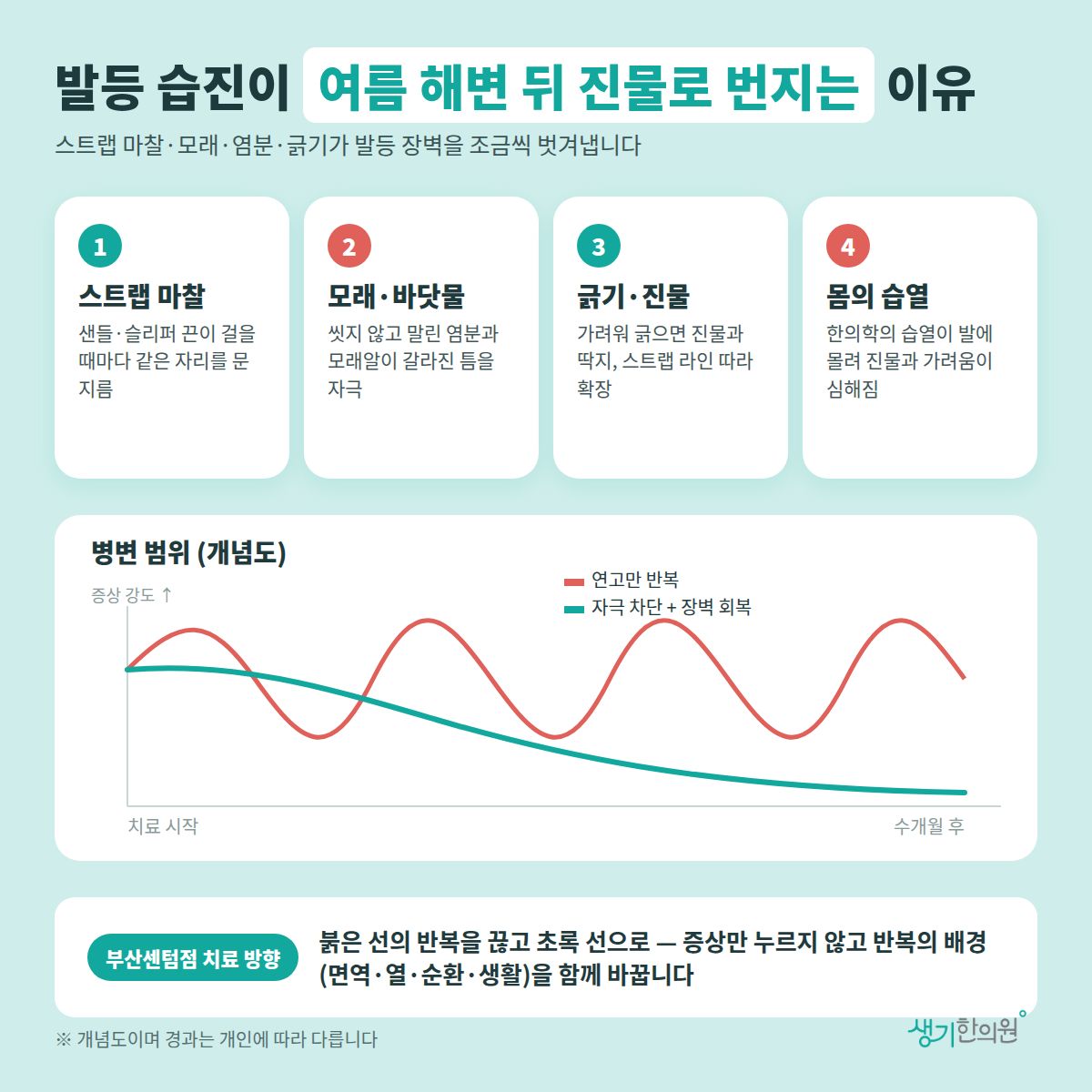 발등 습진이 여름 해변 뒤 진물로 번지는 이유 — 스트랩 마찰, 모래·바닷물, 긁기·진물, 몸의 습열 4가지와 치료 경과 개념 그래프
