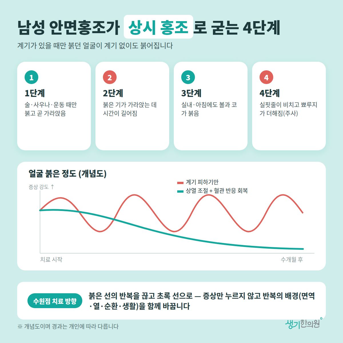 남성 안면홍조가 상시 홍조로 굳는 4단계 — 1단계, 2단계, 3단계, 4단계 4가지와 치료 경과 개념 그래프