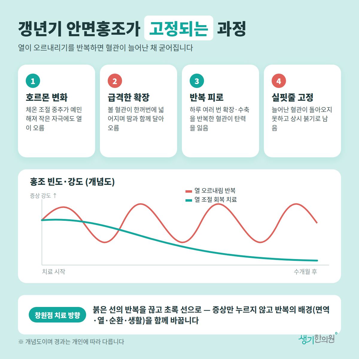갱년기 안면홍조가 고정되는 과정 — 호르몬 변화, 급격한 확장, 반복 피로, 실핏줄 고정 4가지와 치료 경과 개념 그래프
