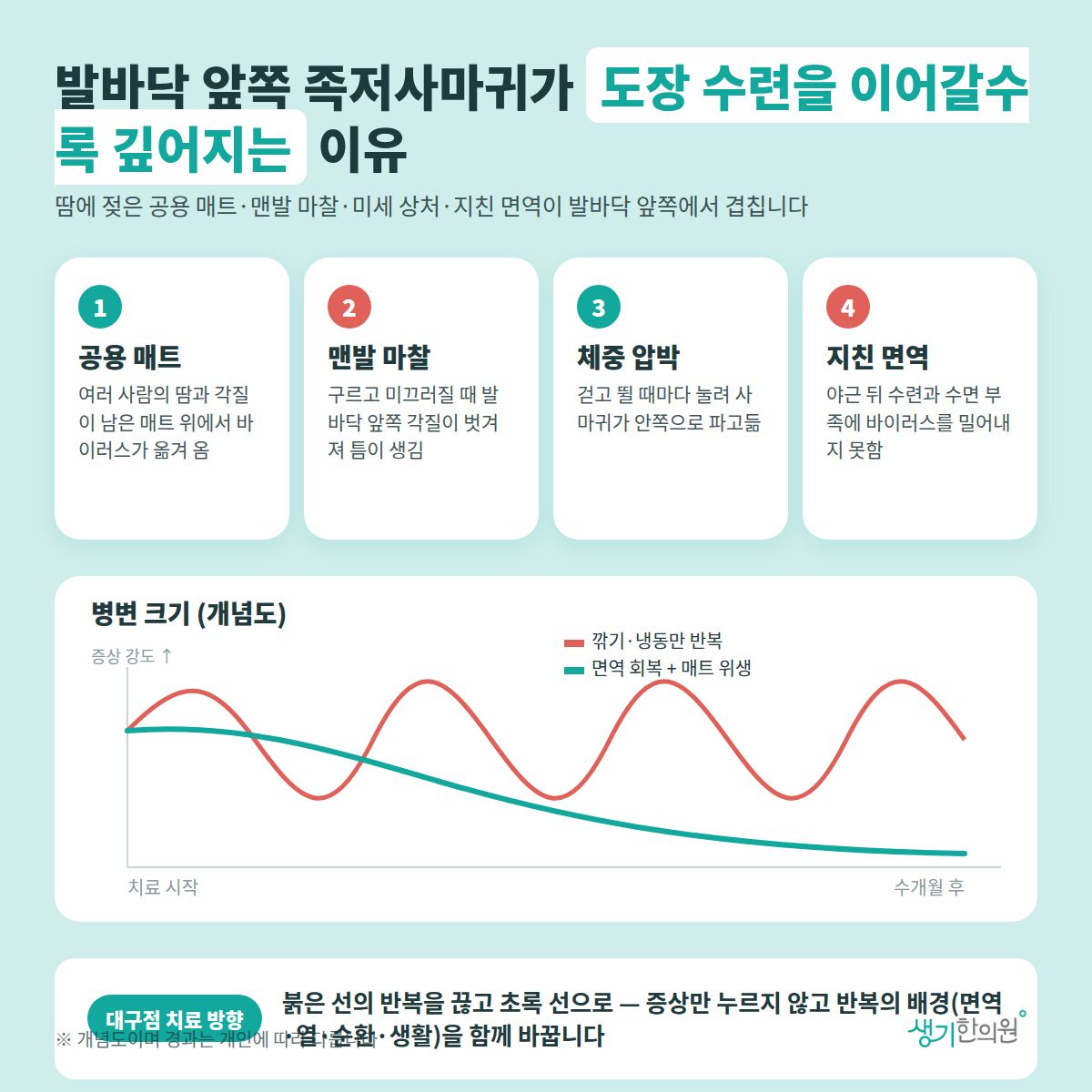 발바닥 앞쪽 족저사마귀가 도장 수련을 이어갈수록 깊어지는 이유 — 공용 매트, 맨발 마찰, 체중 압박, 지친 면역 4가지와 치료 경과 개념 그래프