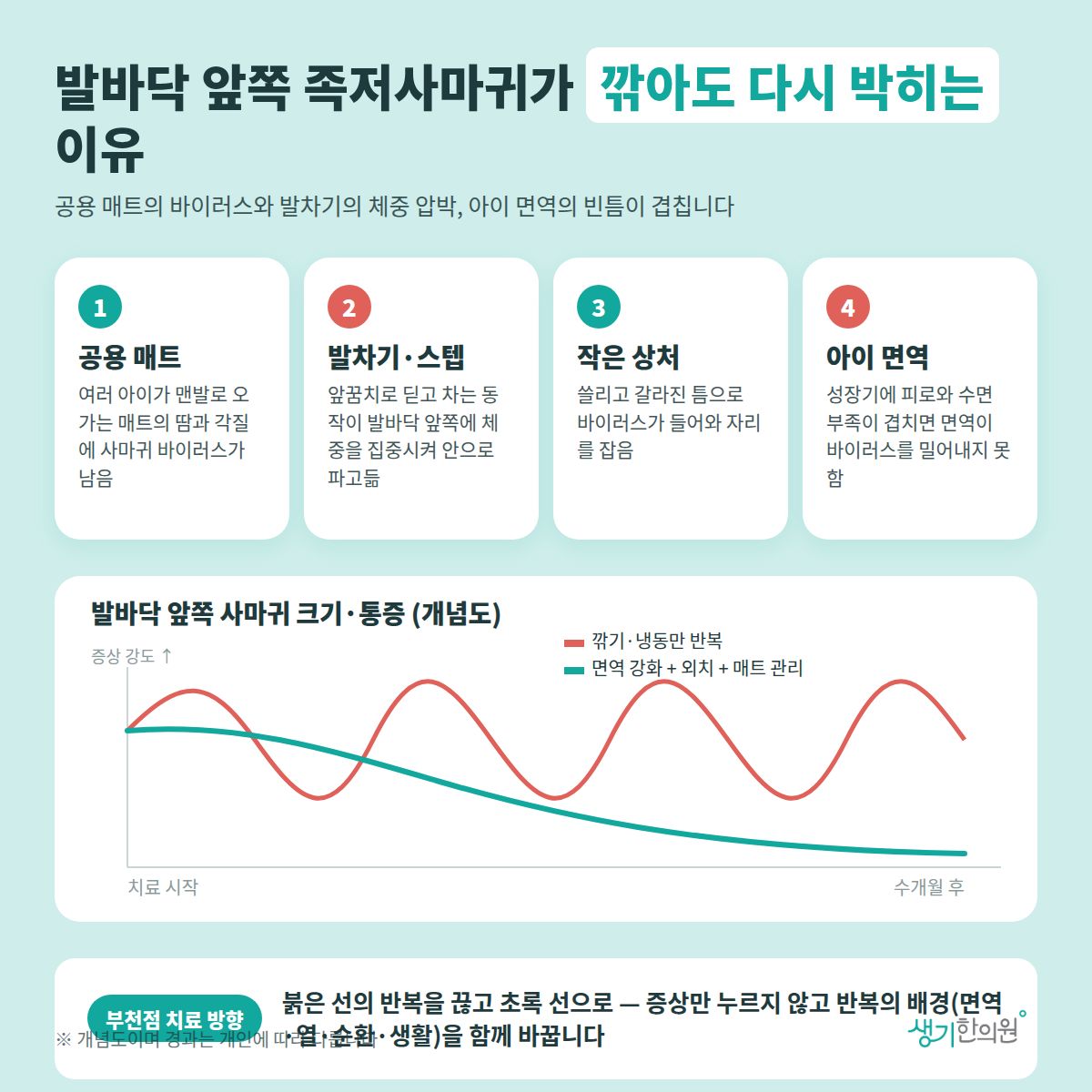 발바닥 앞쪽 족저사마귀가 깎아도 다시 박히는 이유 — 공용 매트, 발차기·스텝, 작은 상처, 아이 면역 4가지와 치료 경과 개념 그래프