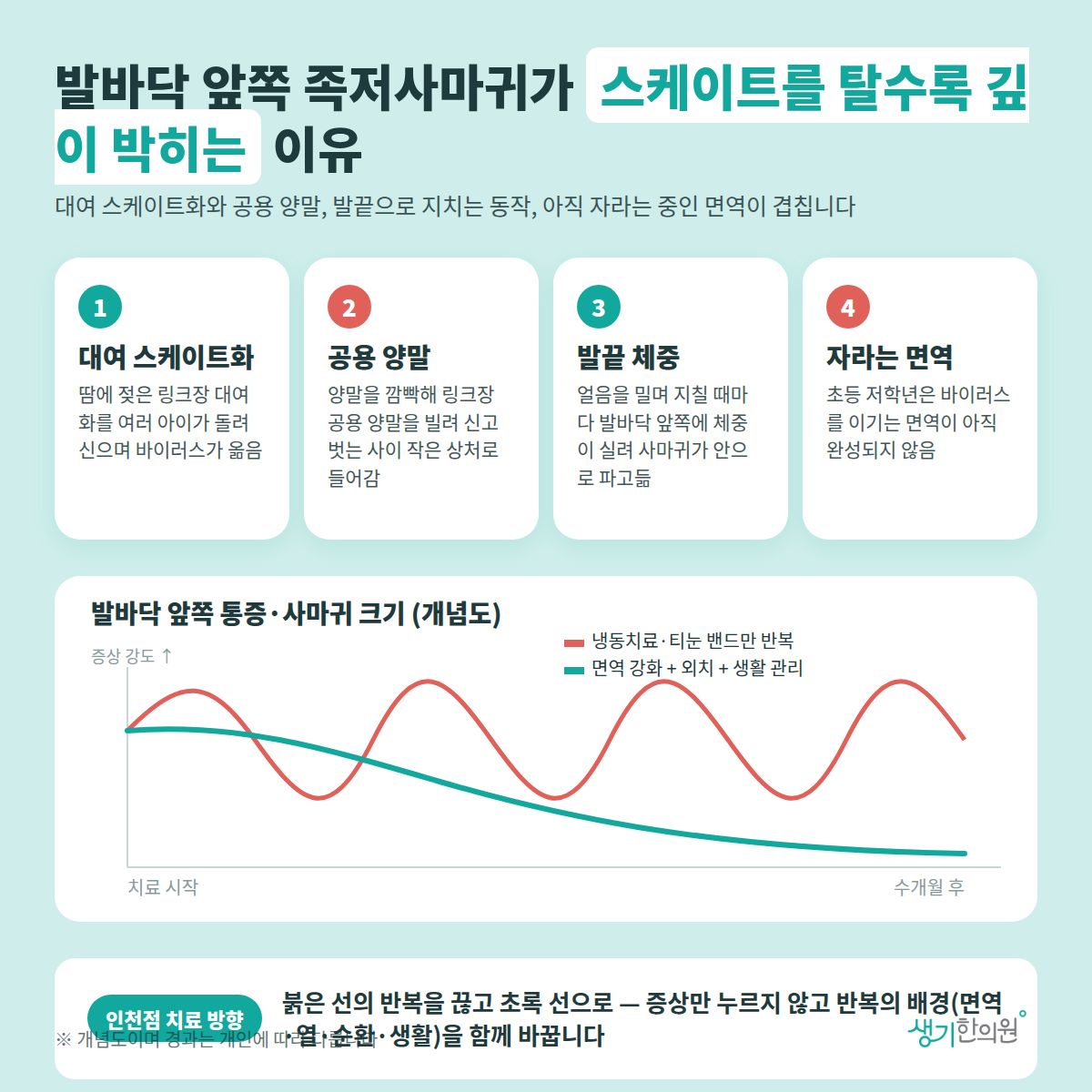 발바닥 앞쪽 족저사마귀가 스케이트를 탈수록 깊이 박히는 이유 — 대여 스케이트화, 공용 양말, 발끝 체중, 자라는 면역 4가지와 치료 경과 개념 그래프