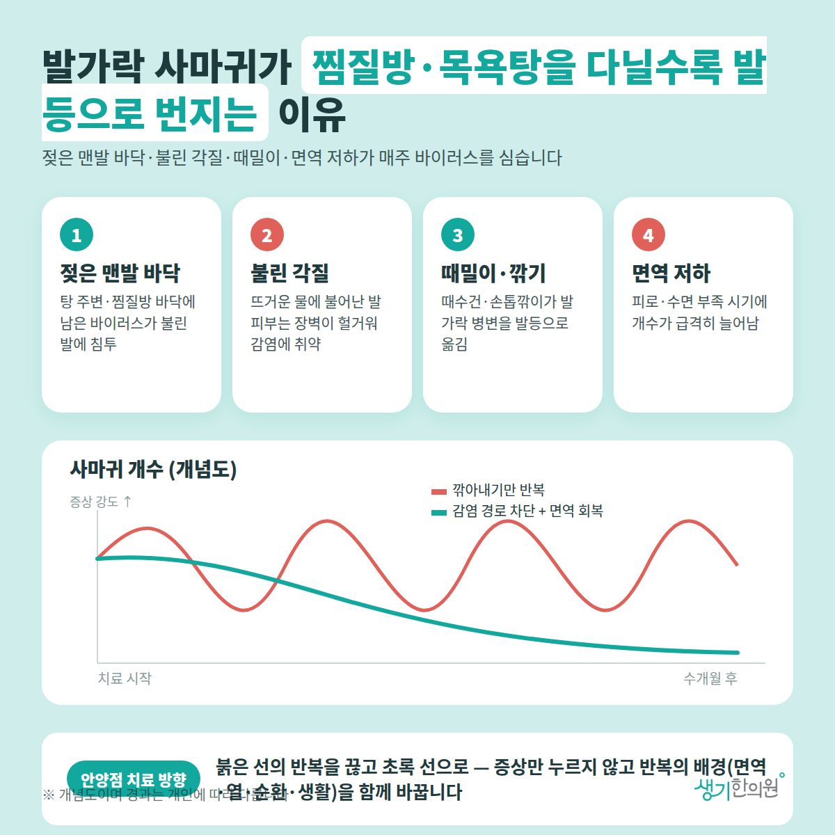 발가락 사마귀가 찜질방·목욕탕을 다닐수록 발등으로 번지는 이유 — 젖은 맨발 바닥, 불린 각질, 때밀이·깎기, 면역 저하 4가지와 치료 경과 개념 그래프