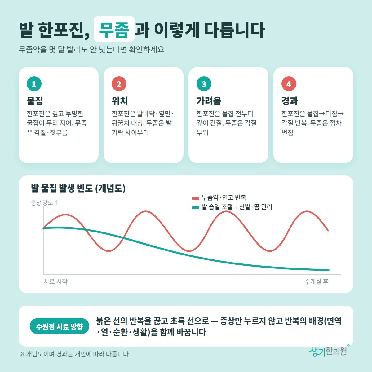 발 한포진, 무좀과 이렇게 다릅니다 — 물집, 위치, 가려움, 경과 4가지와 치료 경과 개념 그래프
