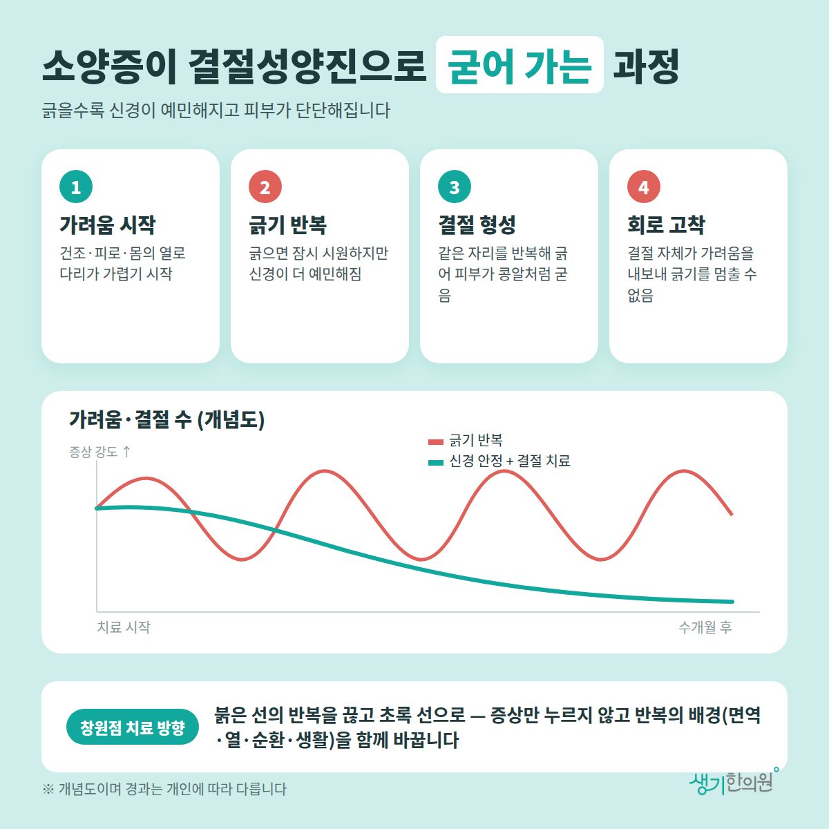 소양증이 결절성양진으로 굳어 가는 과정 — 가려움 시작, 긁기 반복, 결절 형성, 회로 고착 4가지와 치료 경과 개념 그래프