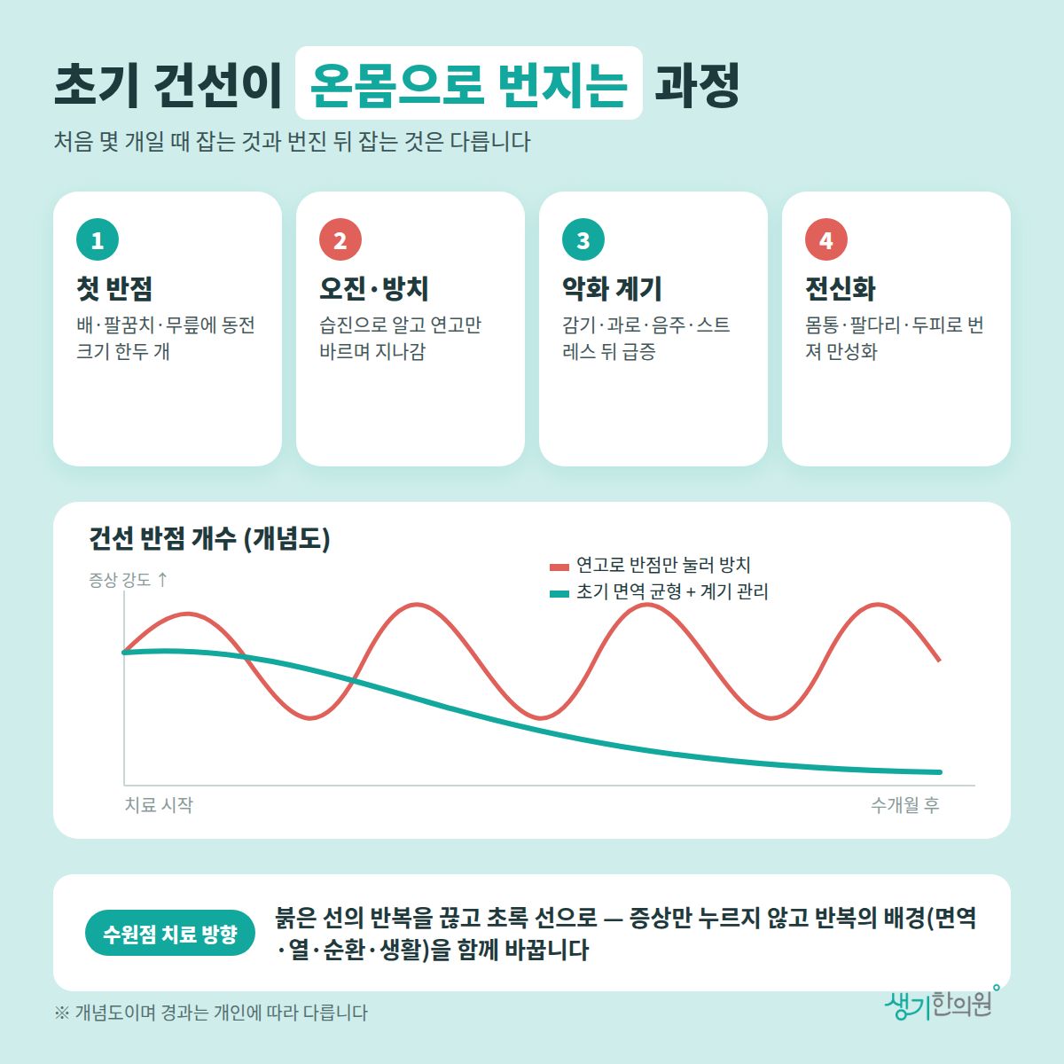초기 건선이 온몸으로 번지는 과정 — 첫 반점, 오진·방치, 악화 계기, 전신화 4가지와 치료 경과 개념 그래프