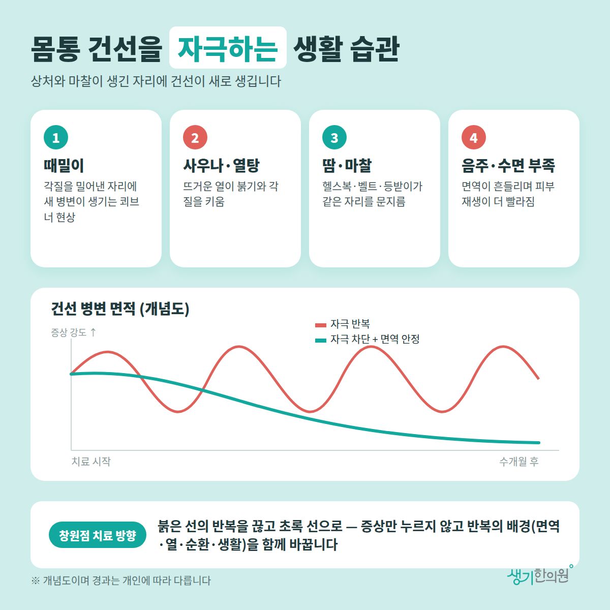 몸통 건선을 자극하는 생활 습관 — 때밀이, 사우나·열탕, 땀·마찰, 음주·수면 부족 4가지와 치료 경과 개념 그래프