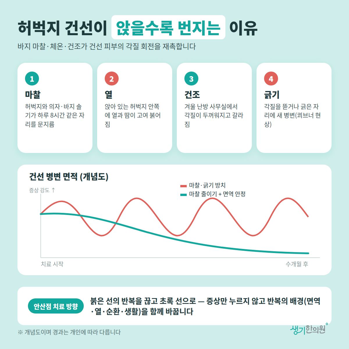 허벅지 건선이 앉을수록 번지는 이유 — 마찰, 열, 건조, 긁기 4가지와 치료 경과 개념 그래프