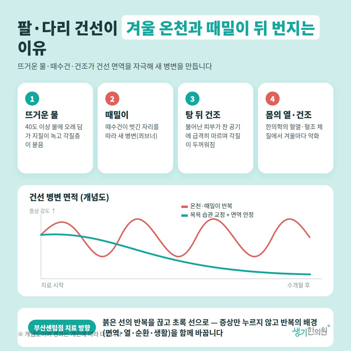 팔·다리 건선이 겨울 온천과 때밀이 뒤 번지는 이유 — 뜨거운 물, 때밀이, 탕 뒤 건조, 몸의 열·건조 4가지와 치료 경과 개념 그래프
