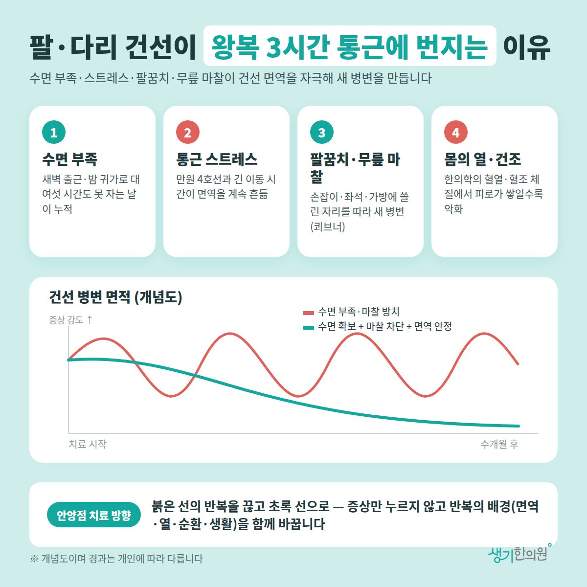 팔·다리 건선이 왕복 3시간 통근에 번지는 이유 — 수면 부족, 통근 스트레스, 팔꿈치·무릎 마찰, 몸의 열·건조 4가지와 치료 경과 개념 그래프