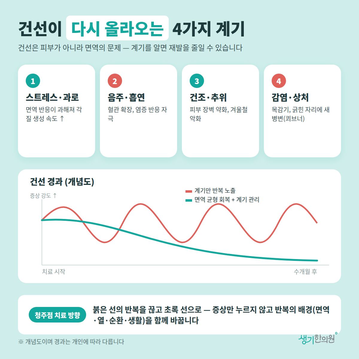 건선이 다시 올라오는 4가지 계기 — 스트레스·과로, 음주·흡연, 건조·추위, 감염·상처와 치료 경과 개념 그래프
