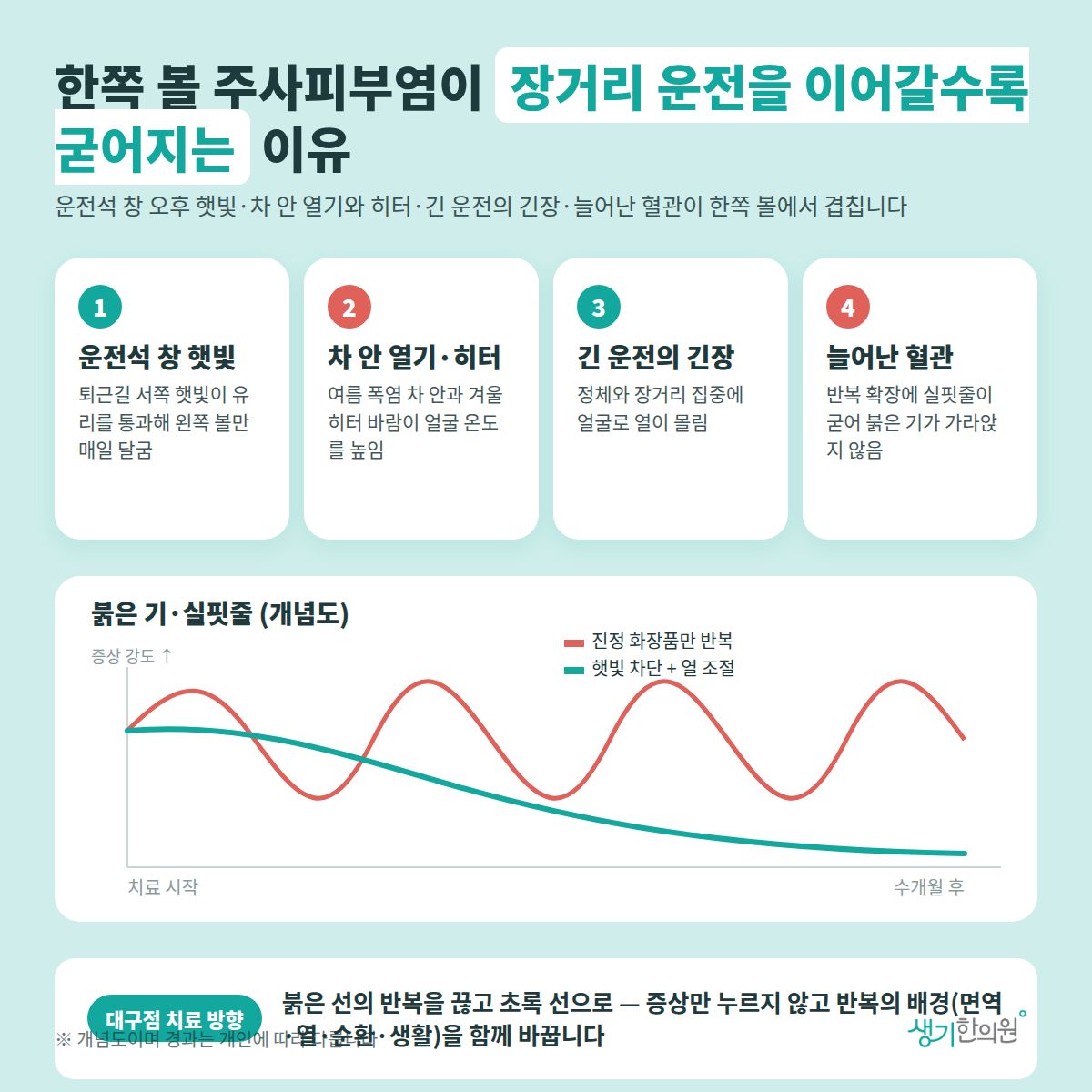 한쪽 볼 주사피부염이 장거리 운전을 이어갈수록 굳어지는 이유 — 운전석 창 햇빛, 차 안 열기·히터, 긴 운전의 긴장, 늘어난 혈관 4가지와 치료 경과 개념 그래프