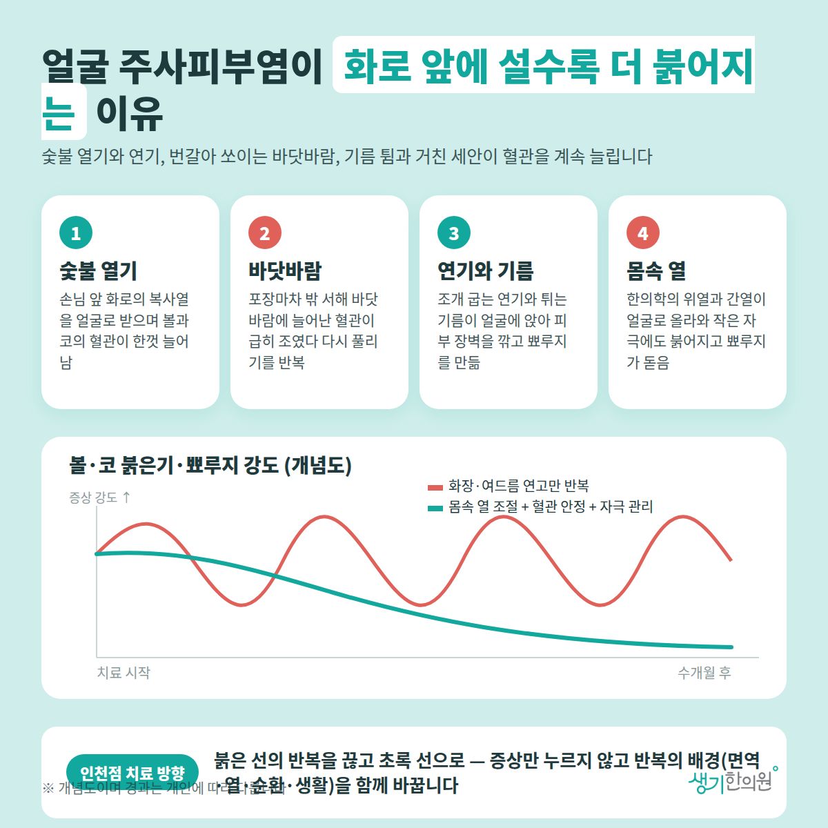 얼굴 주사피부염이 화로 앞에 설수록 더 붉어지는 이유 — 숯불 열기, 바닷바람, 연기와 기름, 몸속 열 4가지와 치료 경과 개념 그래프