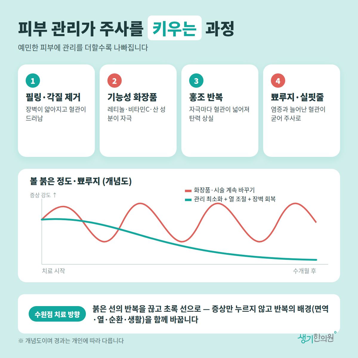 피부 관리가 주사를 키우는 과정 — 필링·각질 제거, 기능성 화장품, 홍조 반복, 뾰루지·실핏줄 4가지와 치료 경과 개념 그래프