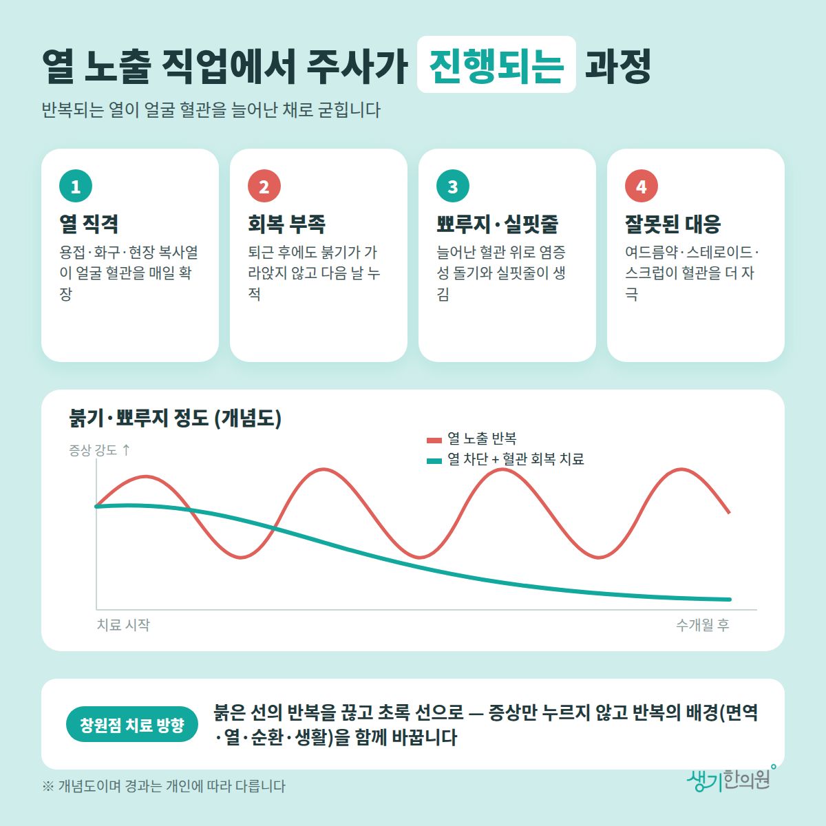 열 노출 직업에서 주사가 진행되는 과정 — 열 직격, 회복 부족, 뾰루지·실핏줄, 잘못된 대응 4가지와 치료 경과 개념 그래프