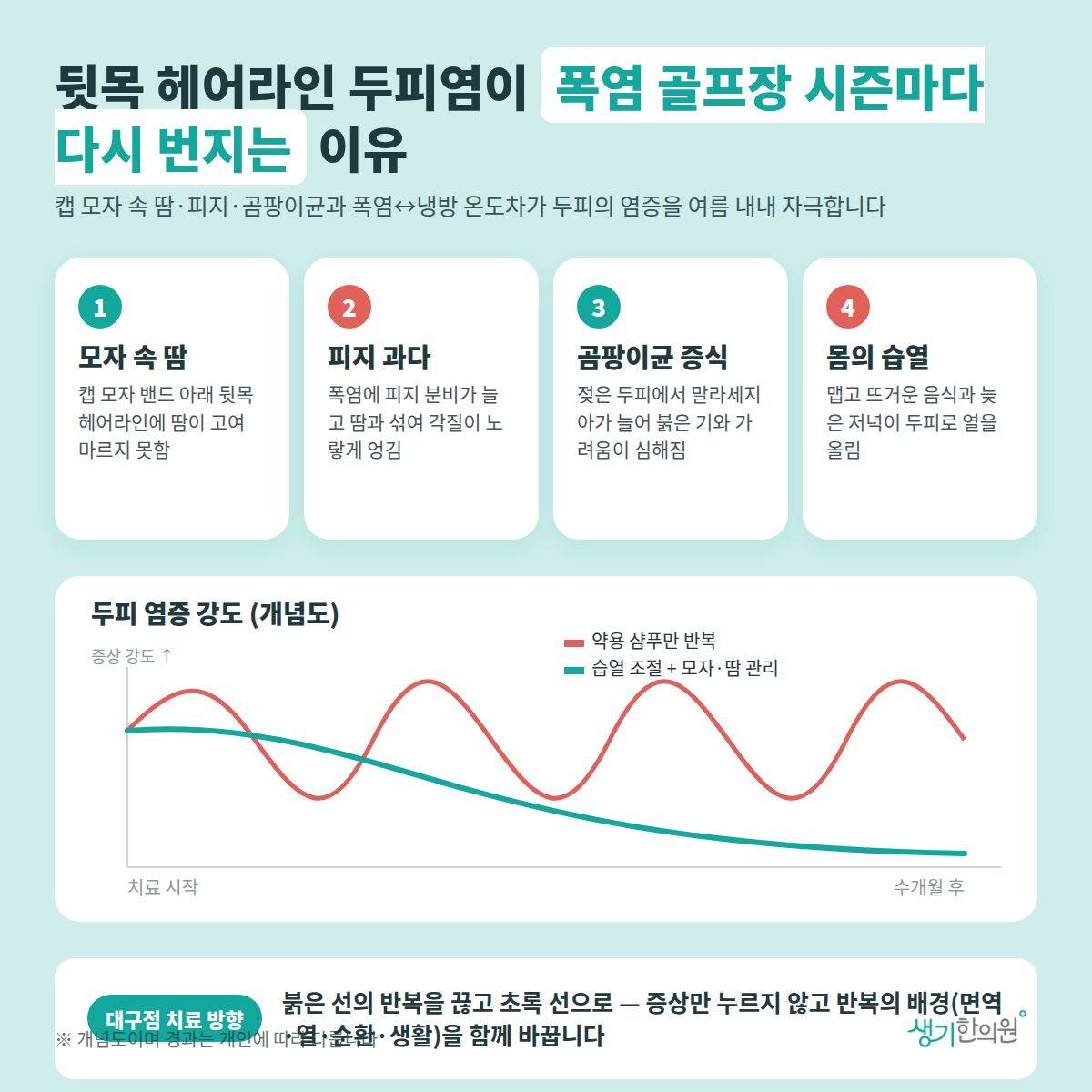 뒷목 헤어라인 두피염이 폭염 골프장 시즌마다 다시 번지는 이유 — 모자 속 땀, 피지 과다, 곰팡이균 증식, 몸의 습열 4가지와 치료 경과 개념 그래프