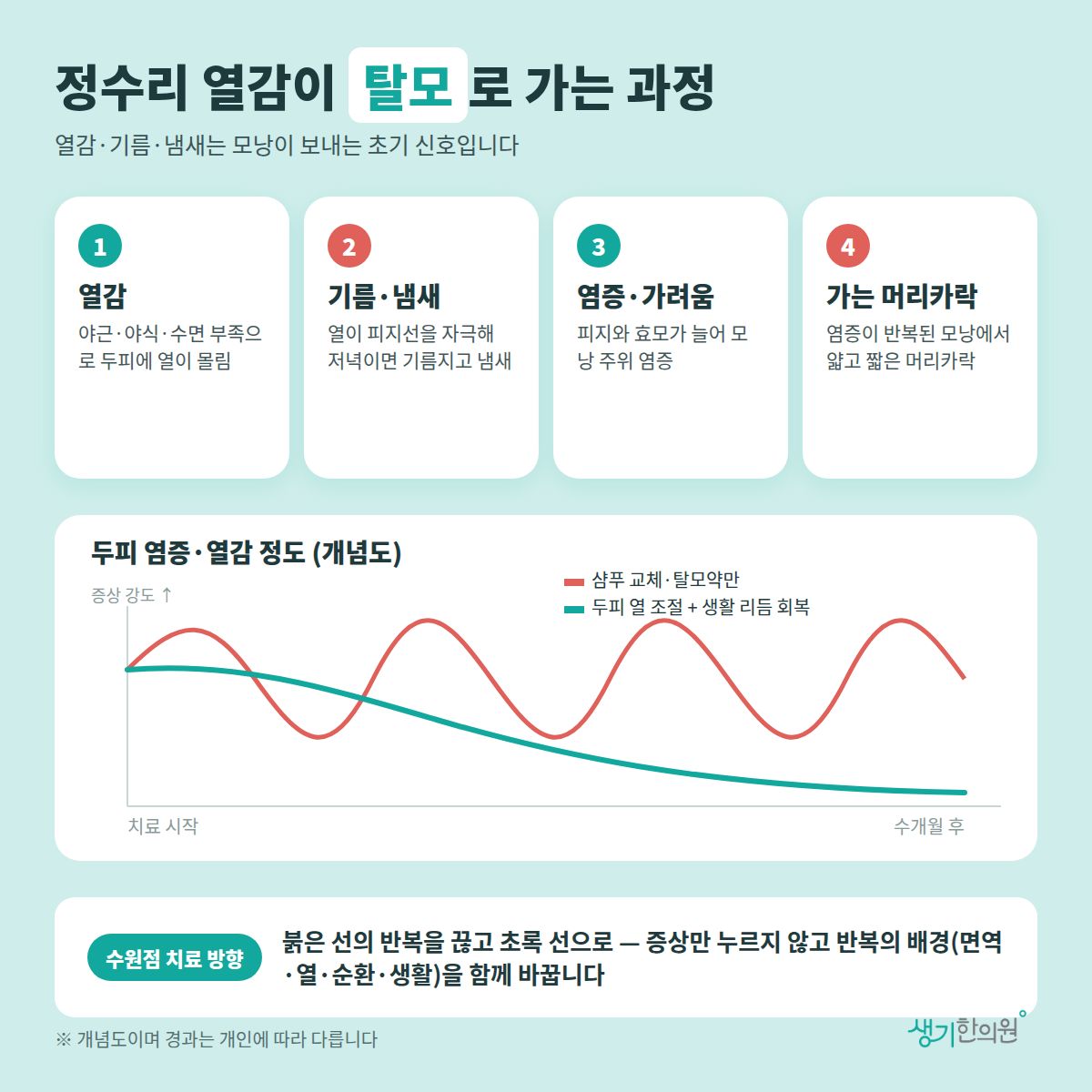 정수리 열감이 탈모로 가는 과정 — 열감, 기름·냄새, 염증·가려움, 가는 머리카락 4가지와 치료 경과 개념 그래프