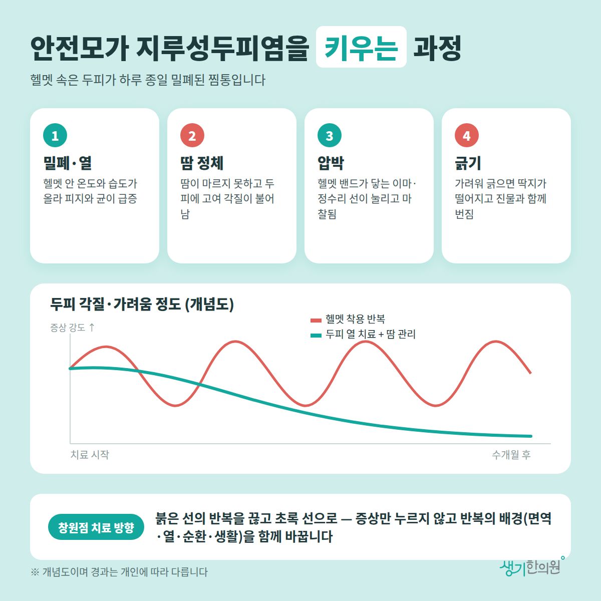 안전모가 지루성두피염을 키우는 과정 — 밀폐·열, 땀 정체, 압박, 긁기 4가지와 치료 경과 개념 그래프
