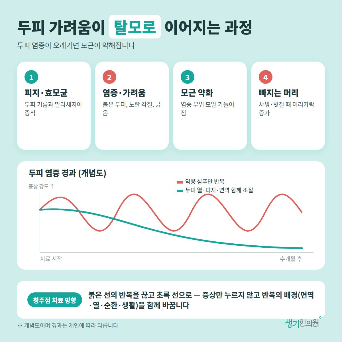 두피 가려움이 탈모로 이어지는 과정 — 피지·효모균, 염증·가려움, 모근 약화, 빠지는 머리 4가지와 치료 경과 개념 그래프