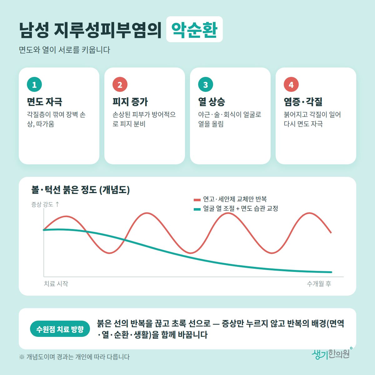 남성 지루성피부염의 악순환 — 면도 자극, 피지 증가, 열 상승, 염증·각질 4가지와 치료 경과 개념 그래프