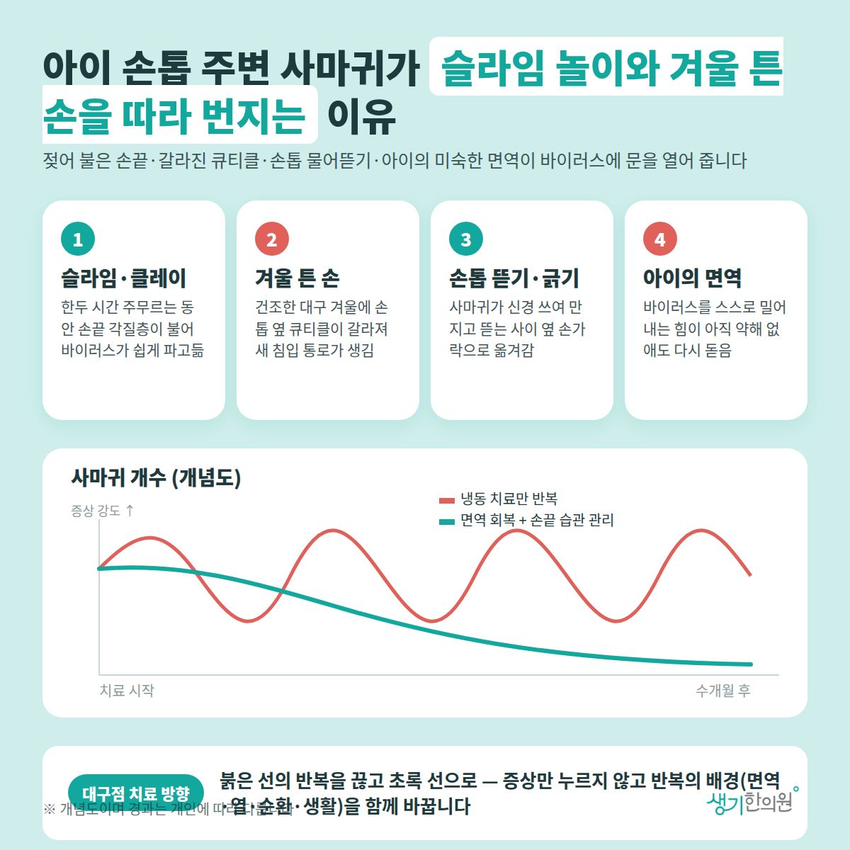 아이 손톱 주변 사마귀가 슬라임 놀이와 겨울 튼 손을 따라 번지는 이유 — 슬라임·클레이, 겨울 튼 손, 손톱 뜯기·긁기, 아이의 면역 4가지와 치료 경과 개념 그래프