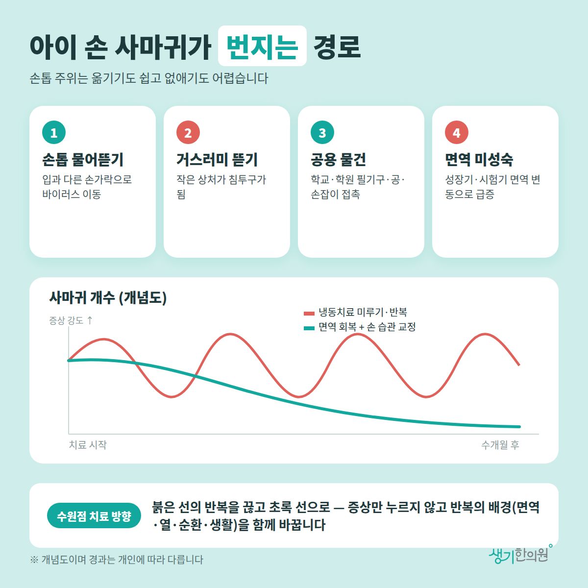 아이 손 사마귀가 번지는 경로 — 손톱 물어뜯기, 거스러미 뜯기, 공용 물건, 면역 미성숙 4가지와 치료 경과 개념 그래프