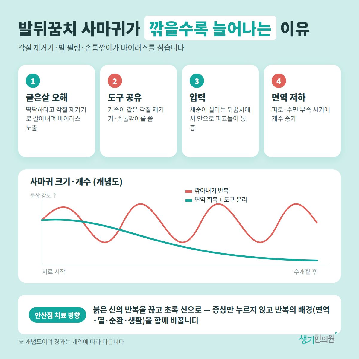 발뒤꿈치 사마귀가 깎을수록 늘어나는 이유 — 굳은살 오해, 도구 공유, 압력, 면역 저하 4가지와 치료 경과 개념 그래프