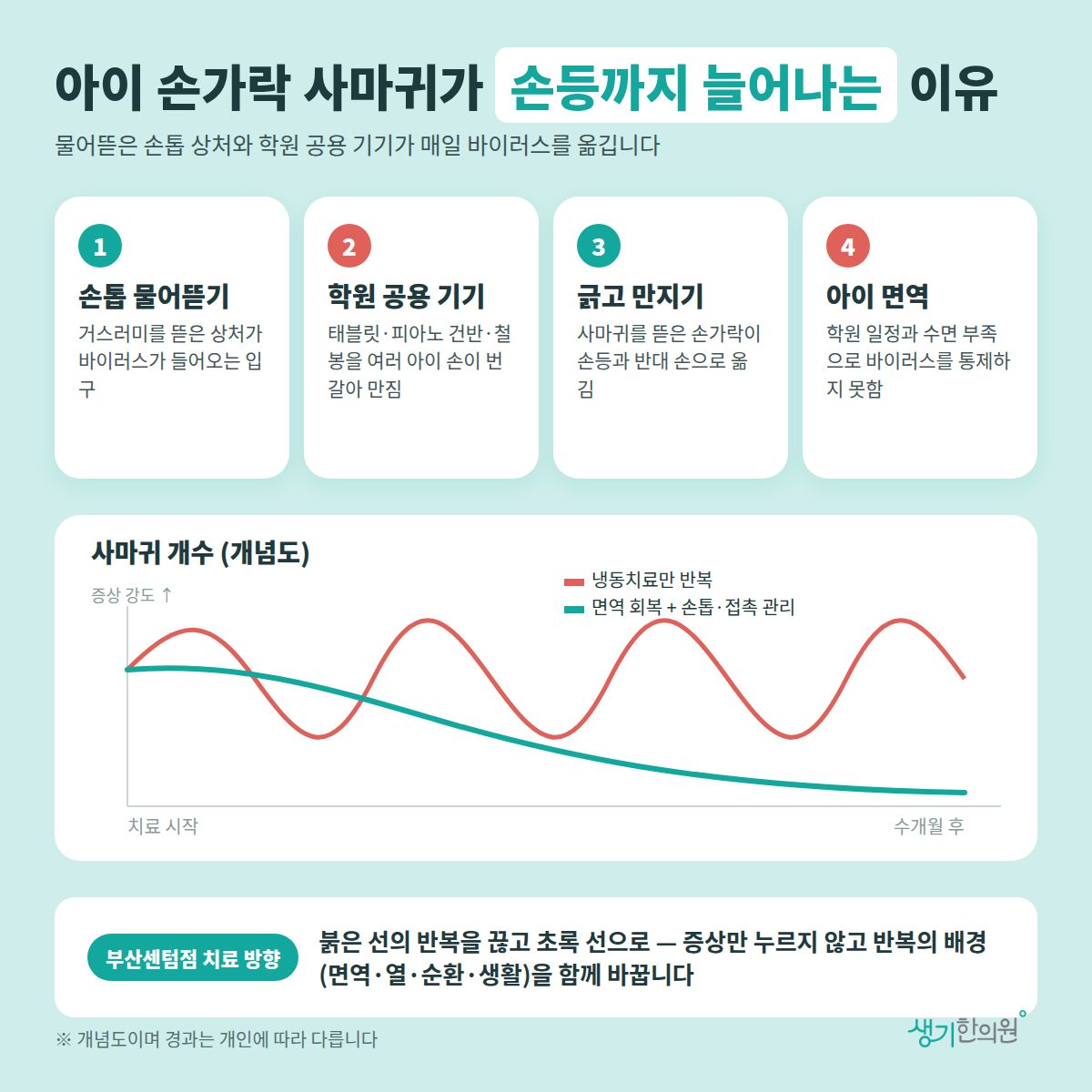 아이 손가락 사마귀가 손등까지 늘어나는 이유 — 손톱 물어뜯기, 학원 공용 기기, 긁고 만지기, 아이 면역 4가지와 치료 경과 개념 그래프