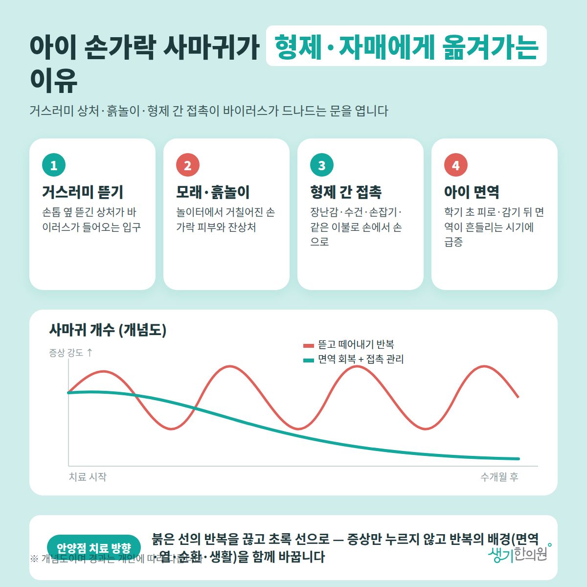 아이 손가락 사마귀가 형제·자매에게 옮겨가는 이유 — 거스러미 뜯기, 모래·흙놀이, 형제 간 접촉, 아이 면역 4가지와 치료 경과 개념 그래프