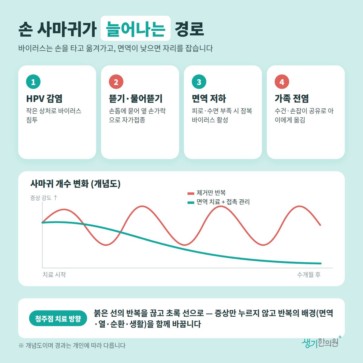 손 사마귀가 늘어나는 경로 — HPV 감염, 뜯기·물어뜯기, 면역 저하, 가족 전염과 치료 경과 개념 그래프